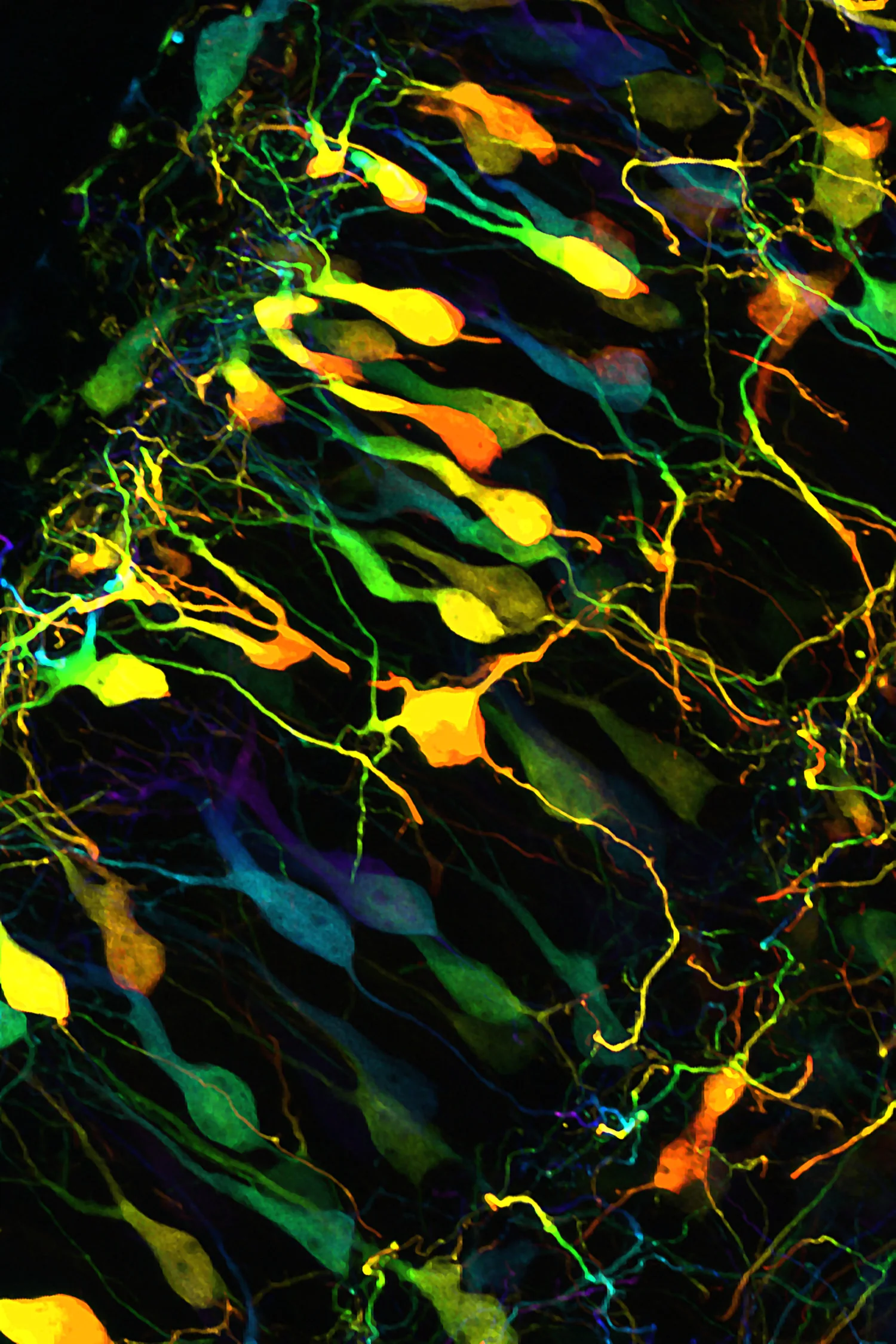 “ Within the In-Between ” reveals the brain cells and their complex interwoven processes. To create this image, varying colours have been used to reflect the changing depths of the neuronal processes as they extend through the brain. This image was captured at high-resolution in 3D using state-of-the-art fluorescence microscopy at the University of Queensland’s Queensland Brain Institute .” This is one of several limited-edition prints that can be purchased for schizophrenia research. Image copyright Luke Maninov Hammond