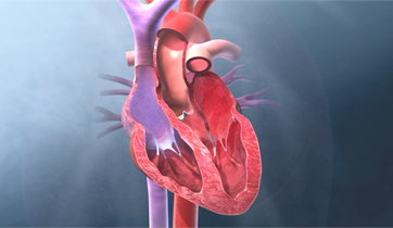  Conjestive Heart Failure, Diastolic phase 