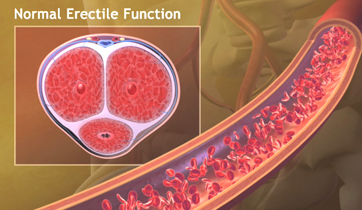  Erectile Dysfunction KO Studios ©2011 All rights reserved 