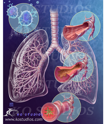 ENT/Respiratory Stock Images — KO Studios Biomedical Animation and  Illustration