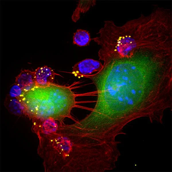 An award-winning image of CTLs attacking a tumor cell (Photo: Sudha Kumari)