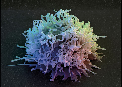 A natural killer cell (Photo: David Scharf)