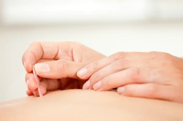Acupuncture hands(1).jpg
