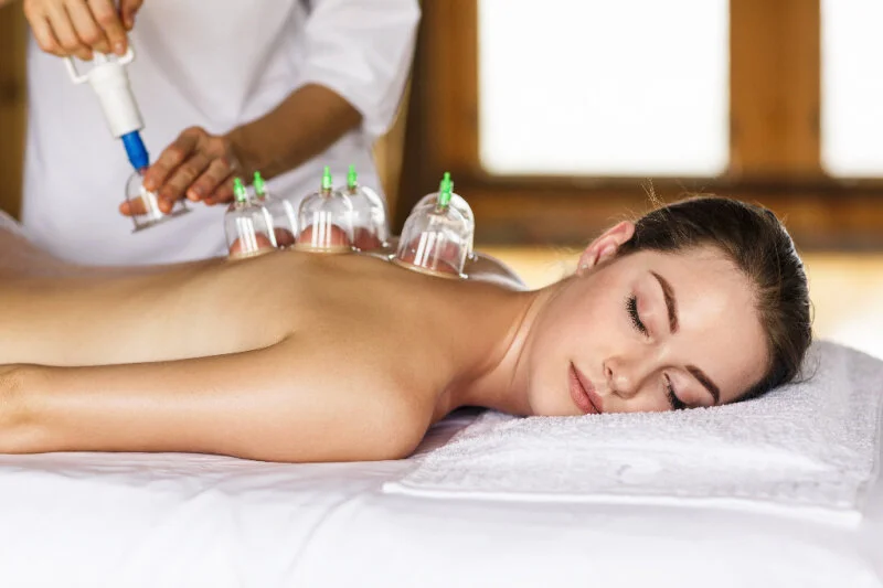 cupping therapy(1).jpg