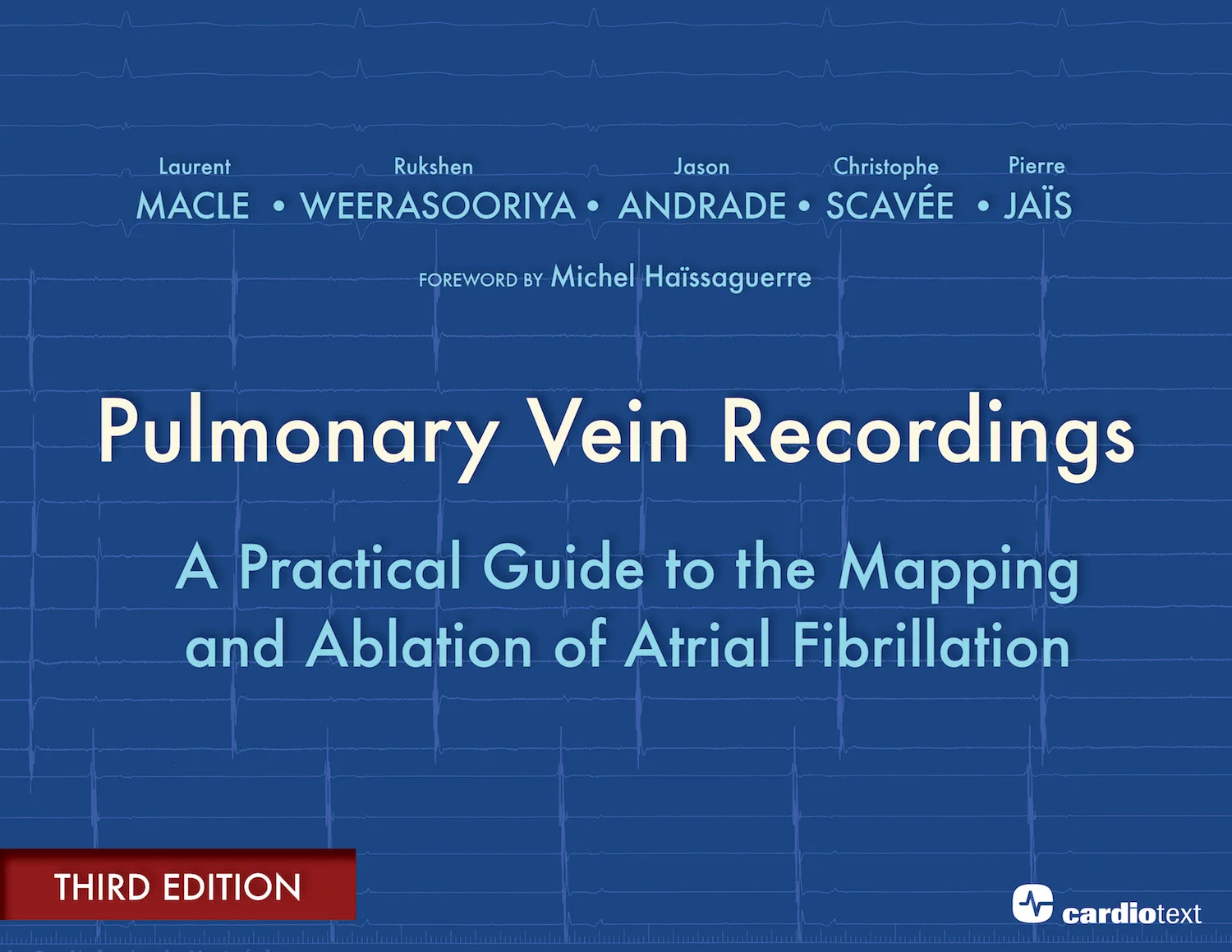 Pulmonary Vein Recordings 3rd Edition