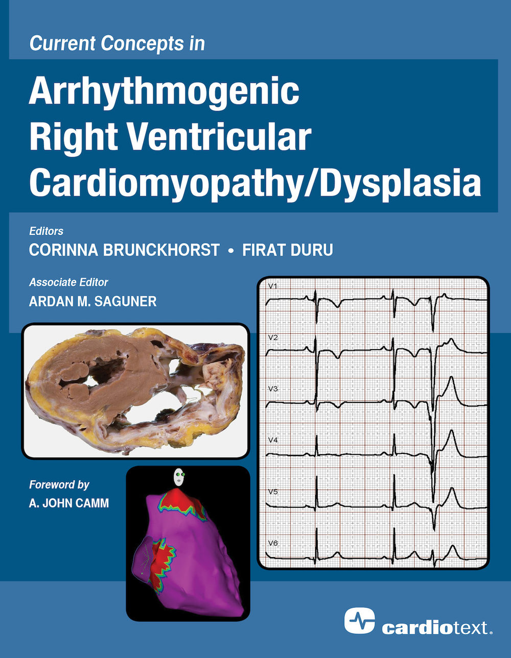 Essential Concepts of Electrophysiology through Case Studies: Intracardiac  EGMs - Ellenbogen 9781935395331 — Cardiotext Publishing - Cardiology Books  and eBooks