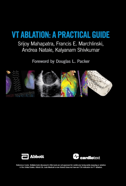 VT Ablation: A Practical Guide First Reprint Edition 2017