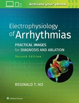 EP of Arrhythmias 2nd ed 9781975101107.jpg