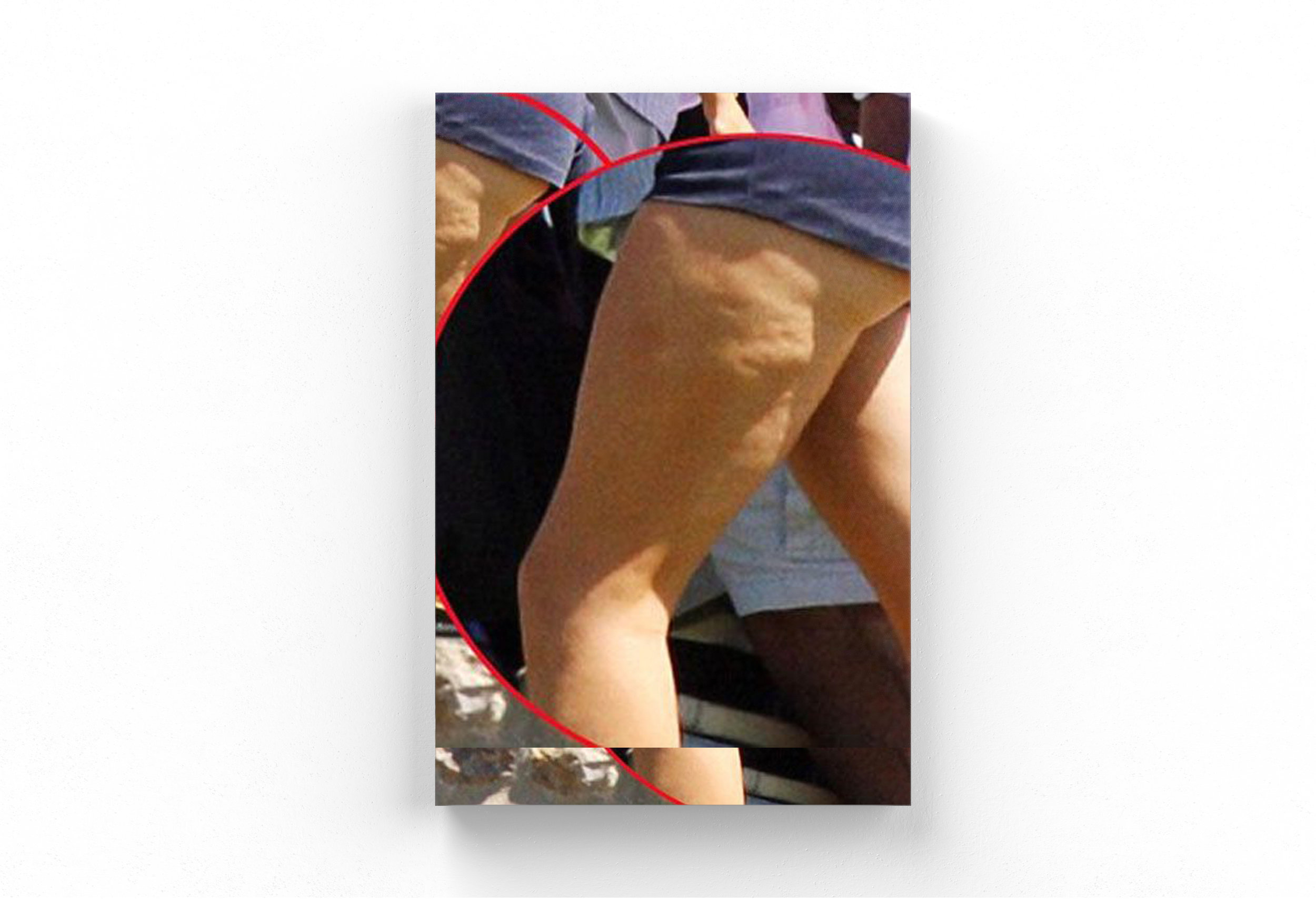 cellulite2.jpg
