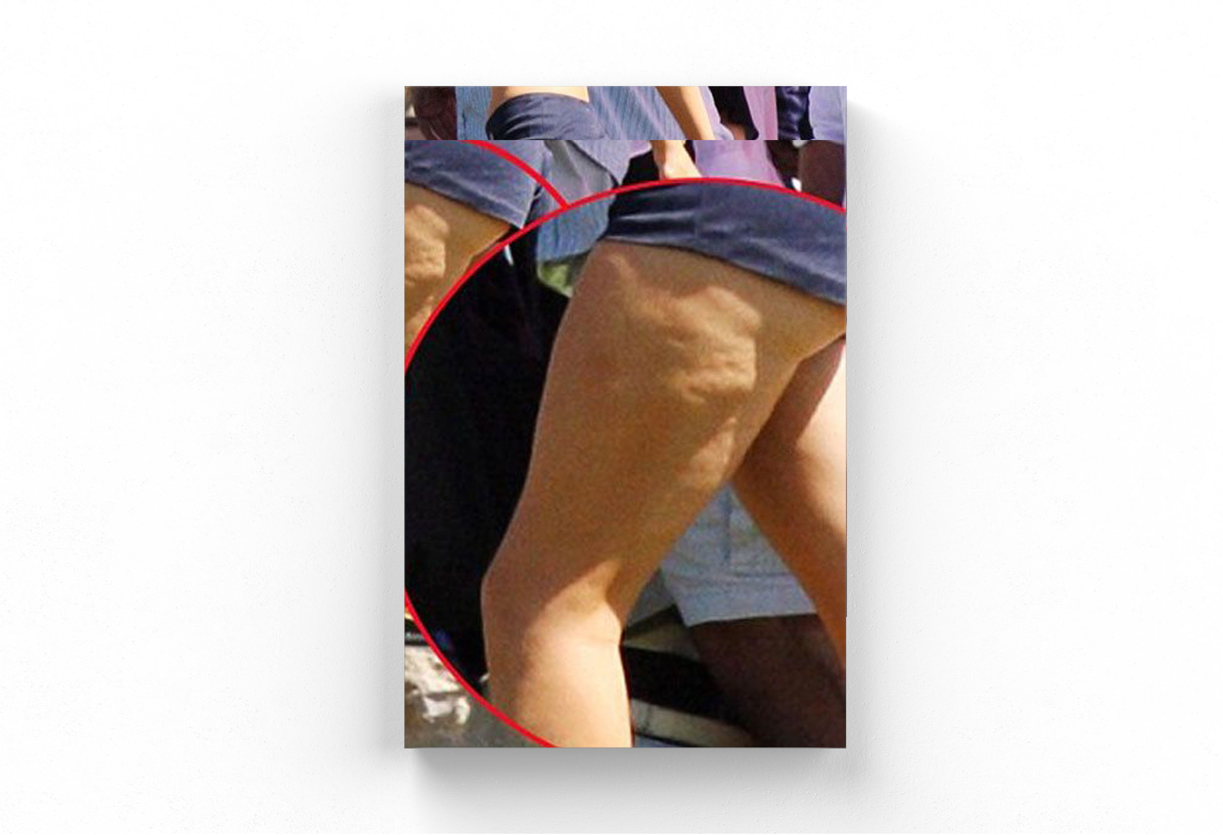 cellulite4.jpg