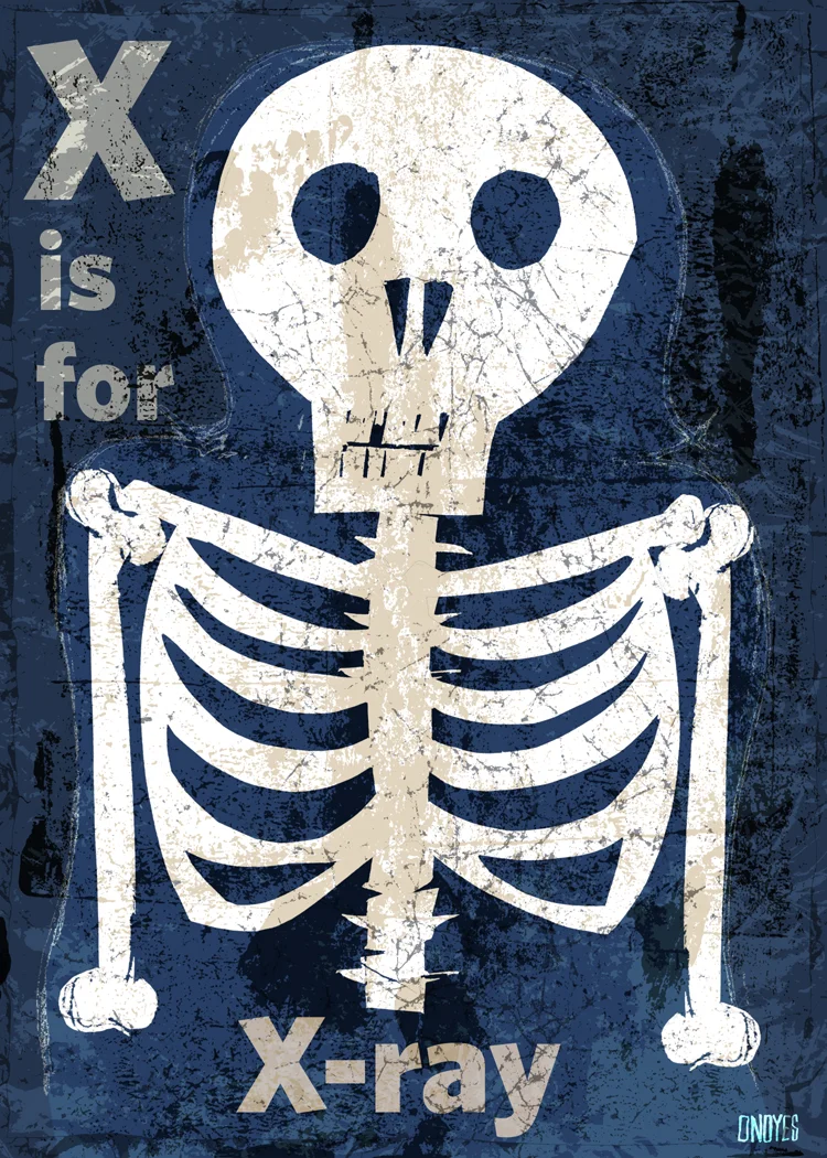 X-is-for-X-Ray.jpg
