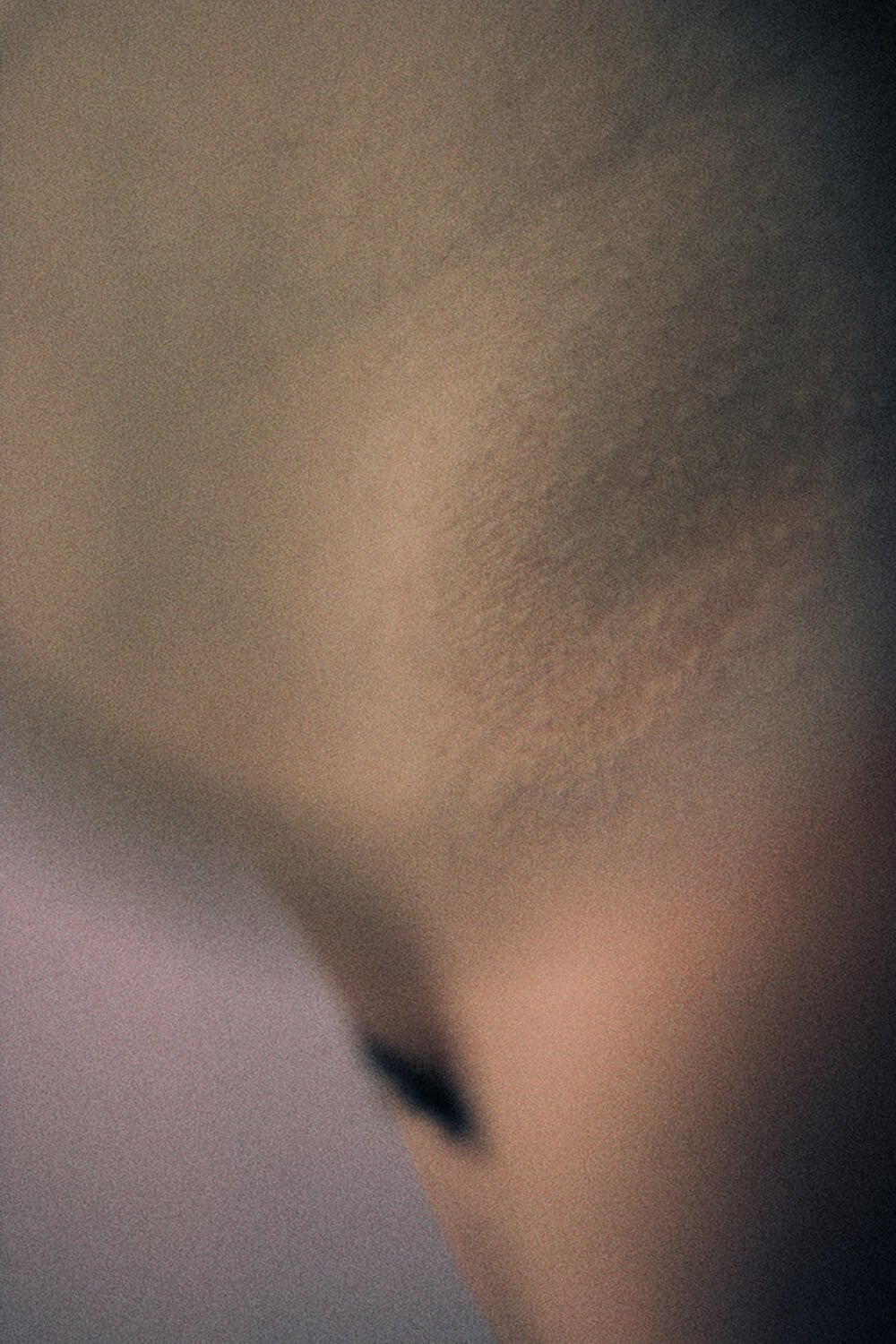 SkinPhotography-MagnusElvarJonsson005.jpg