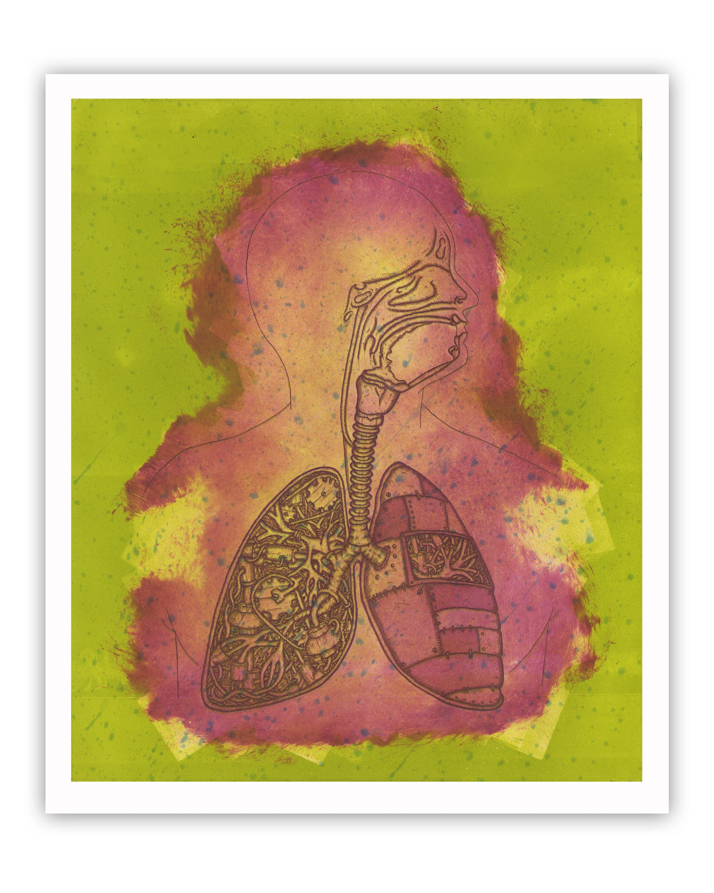 4b iron lung pink green.jpg