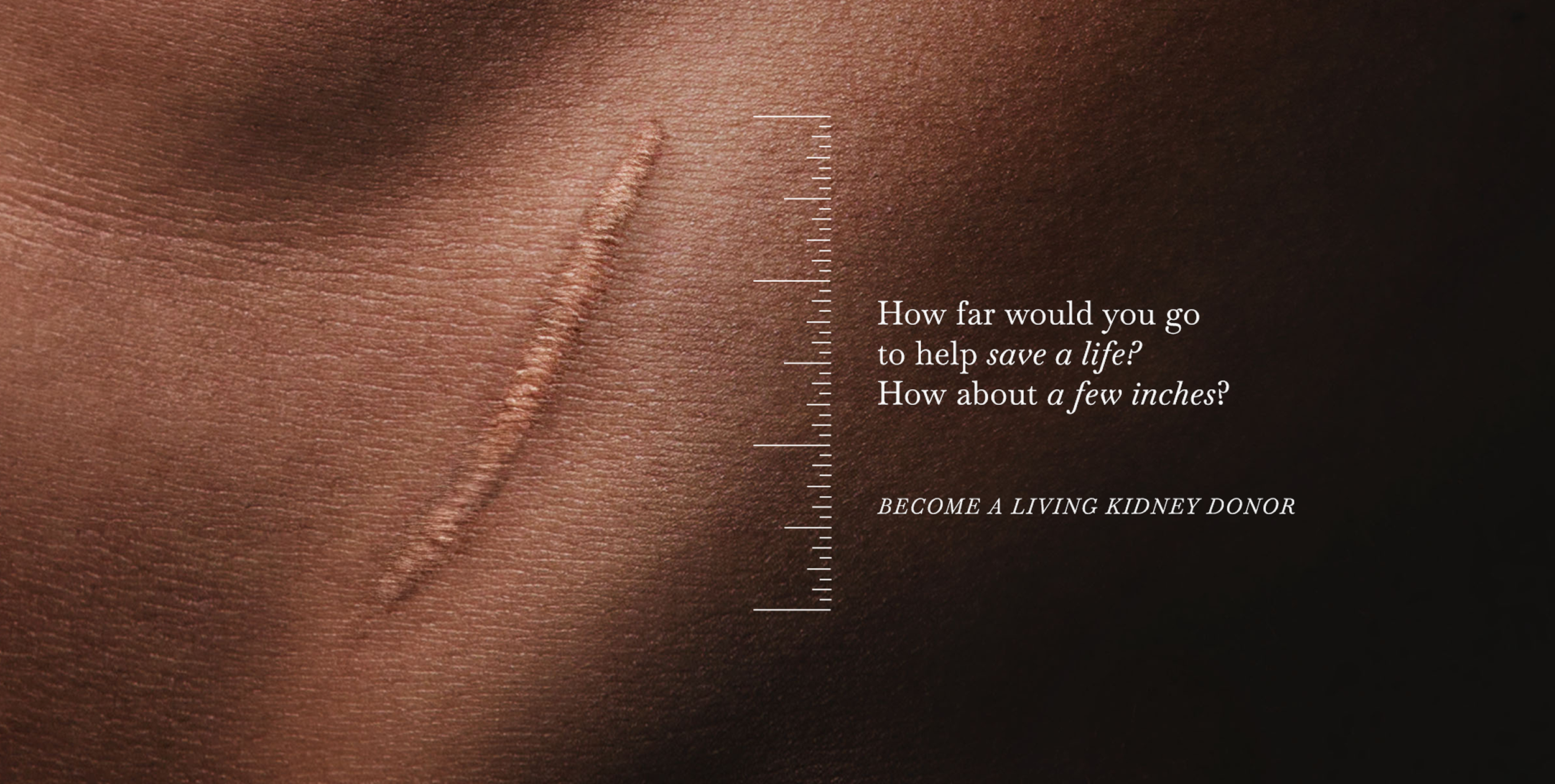 Living Donor Revamp.png