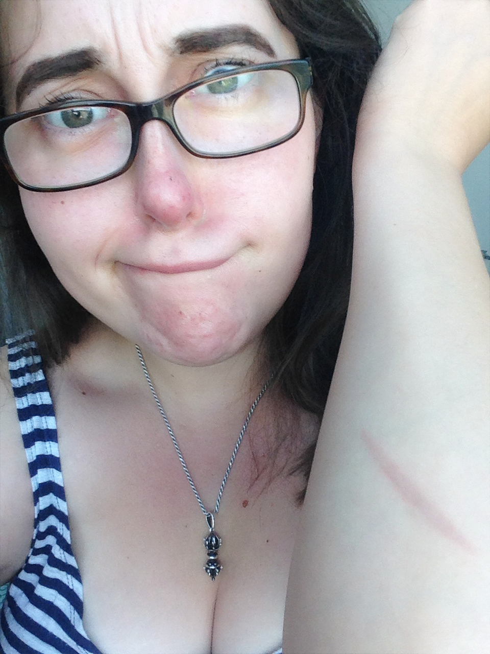 I ironed my arm.... pre-wrinkle treatment?