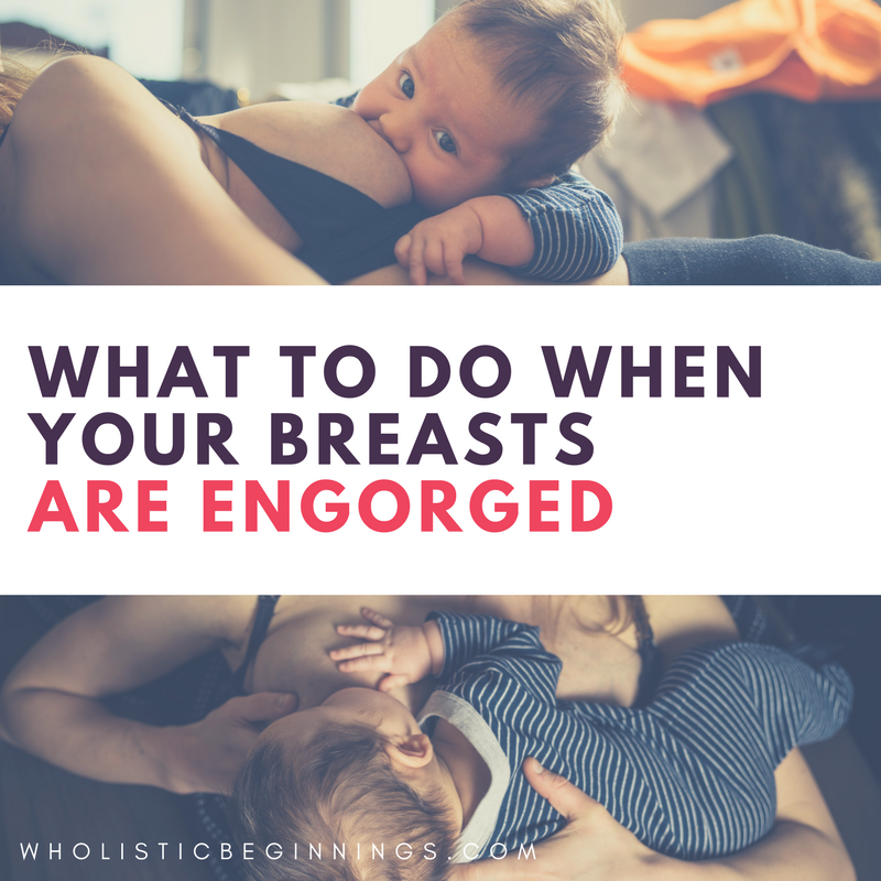 Breast Engorgement - Causes & Simple Tips for Relief