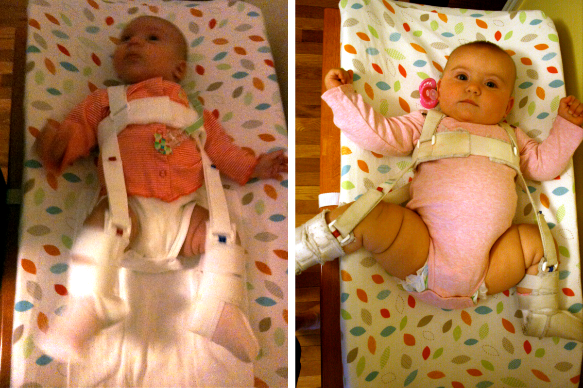 BalloonBloomers_Myla_Harness.png