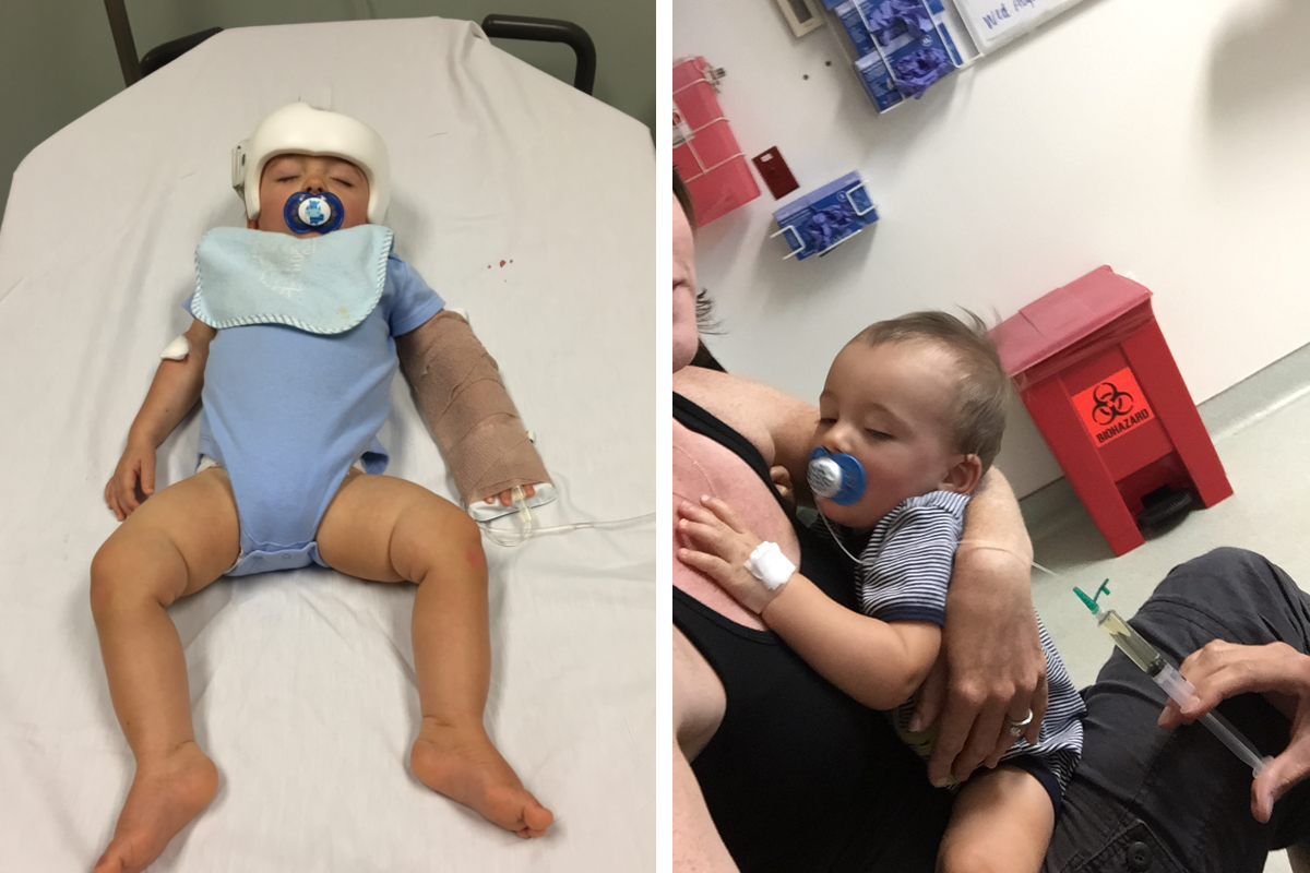 First visit to the hospital in The Outer Banks (L) and the second visit (R) with the feeding gadget my husband rigged up.