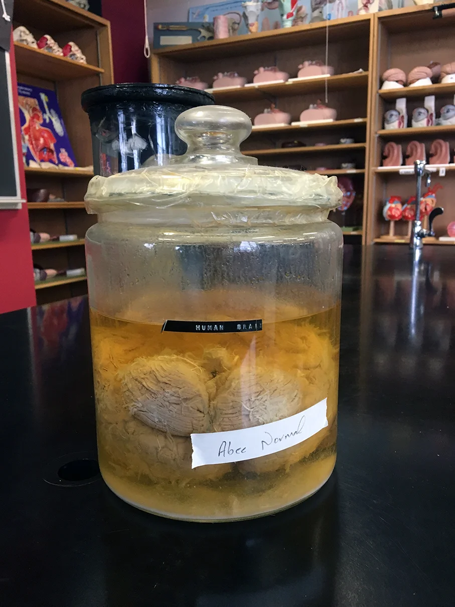 Human brain specimen, which I will be teaching students how to restore, in the collection of St. Xavier University.