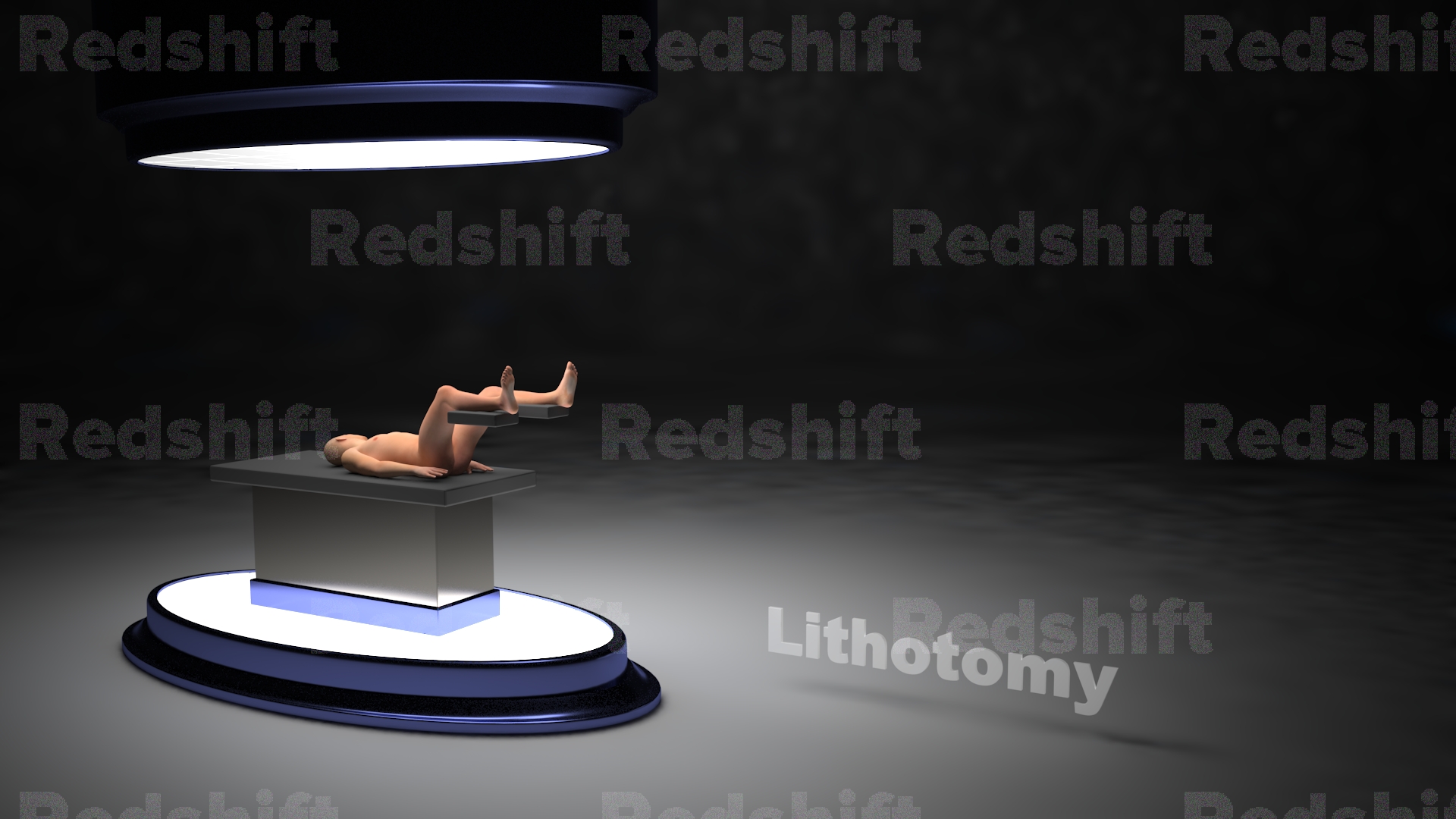 Lithotomy_B.jpg