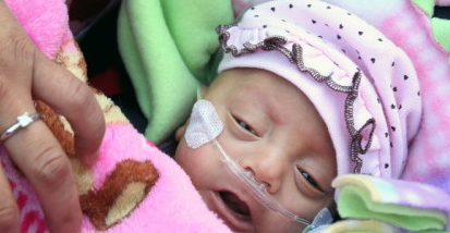 The 2nd Smallest Baby In US (Palm-sized), Is Growing