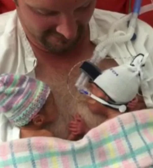 Preemie Babies Hold Hands In 'Unbelievable' Moment Captured On Video