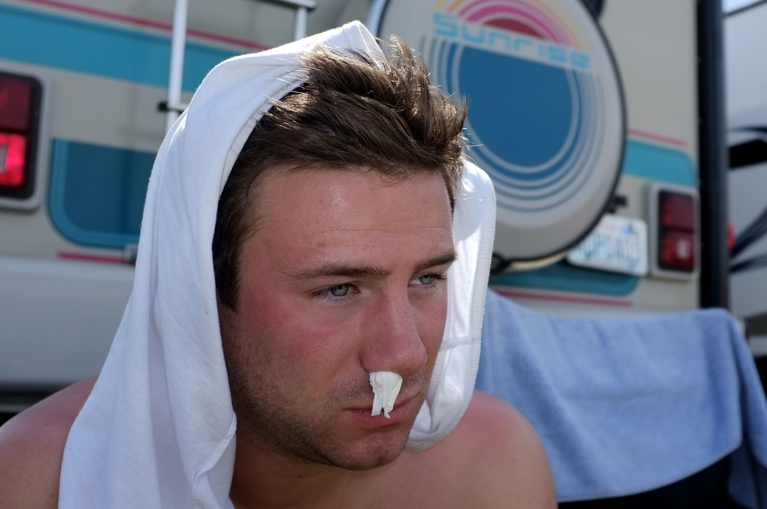 Endless nosebleeds
