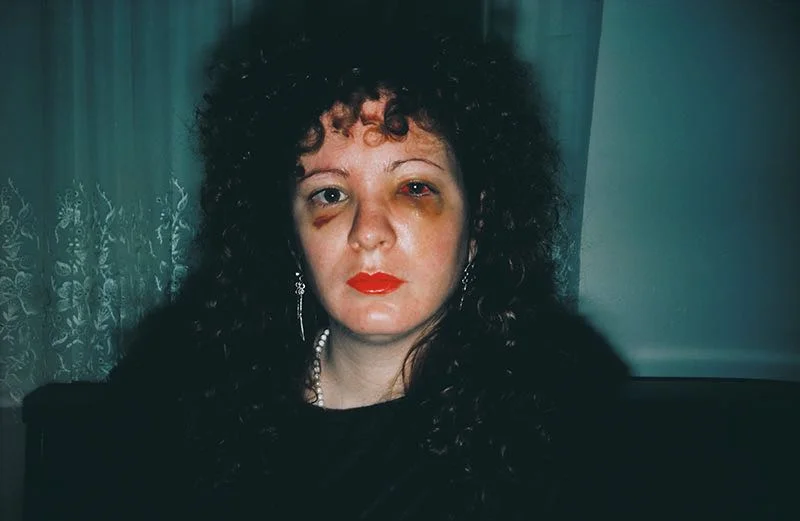Foto: Nan Goldin Nan one month after being battered, 1984 © Nan Goldin