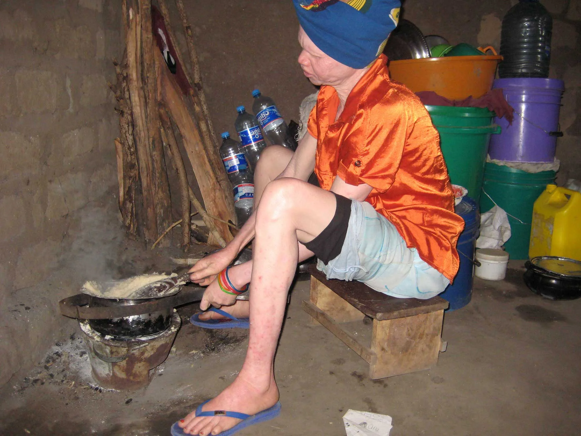 one of the family members with Albinism cooking for the family (Photo by Miango ©)