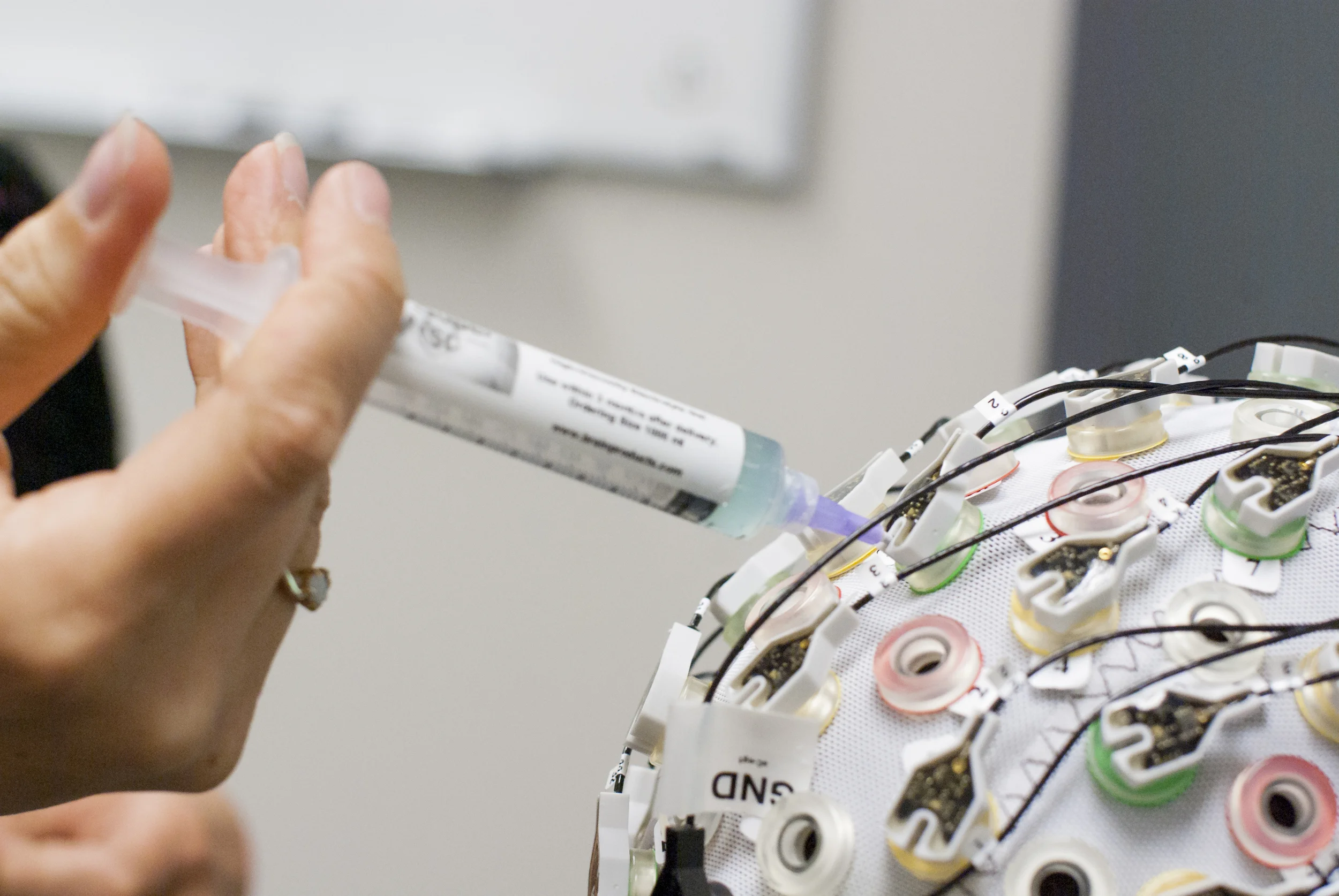 EEG Cap Setup - blunt syringe injecting gel onto scalp