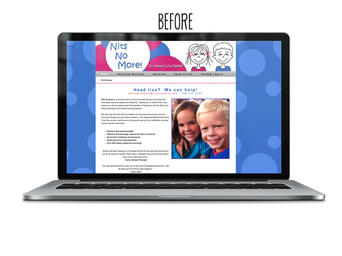 Nits No More Before & After