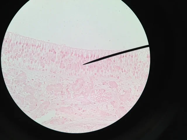 Olfactory Epithelium 400X