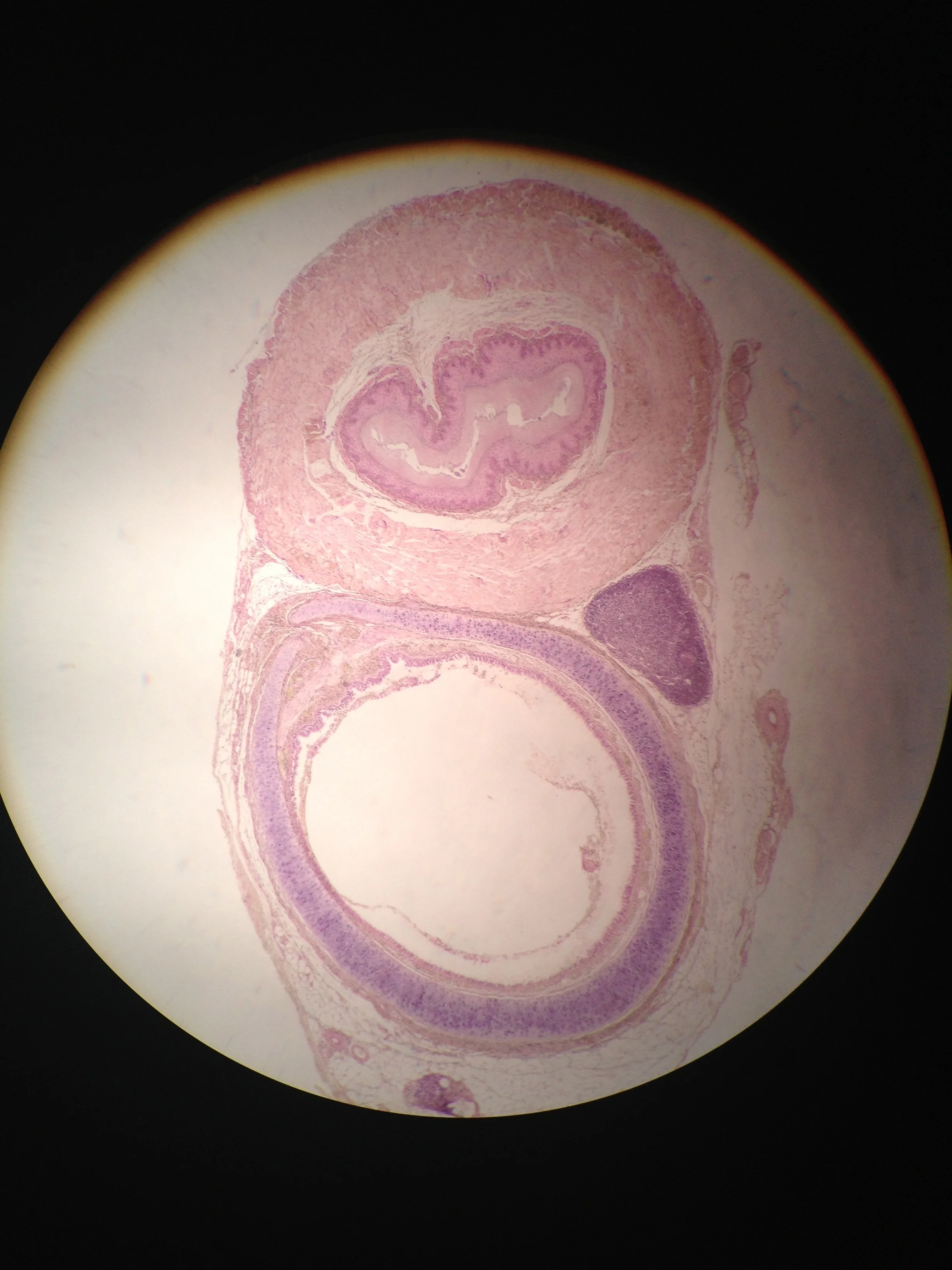 Trachea and Esophagus 40X