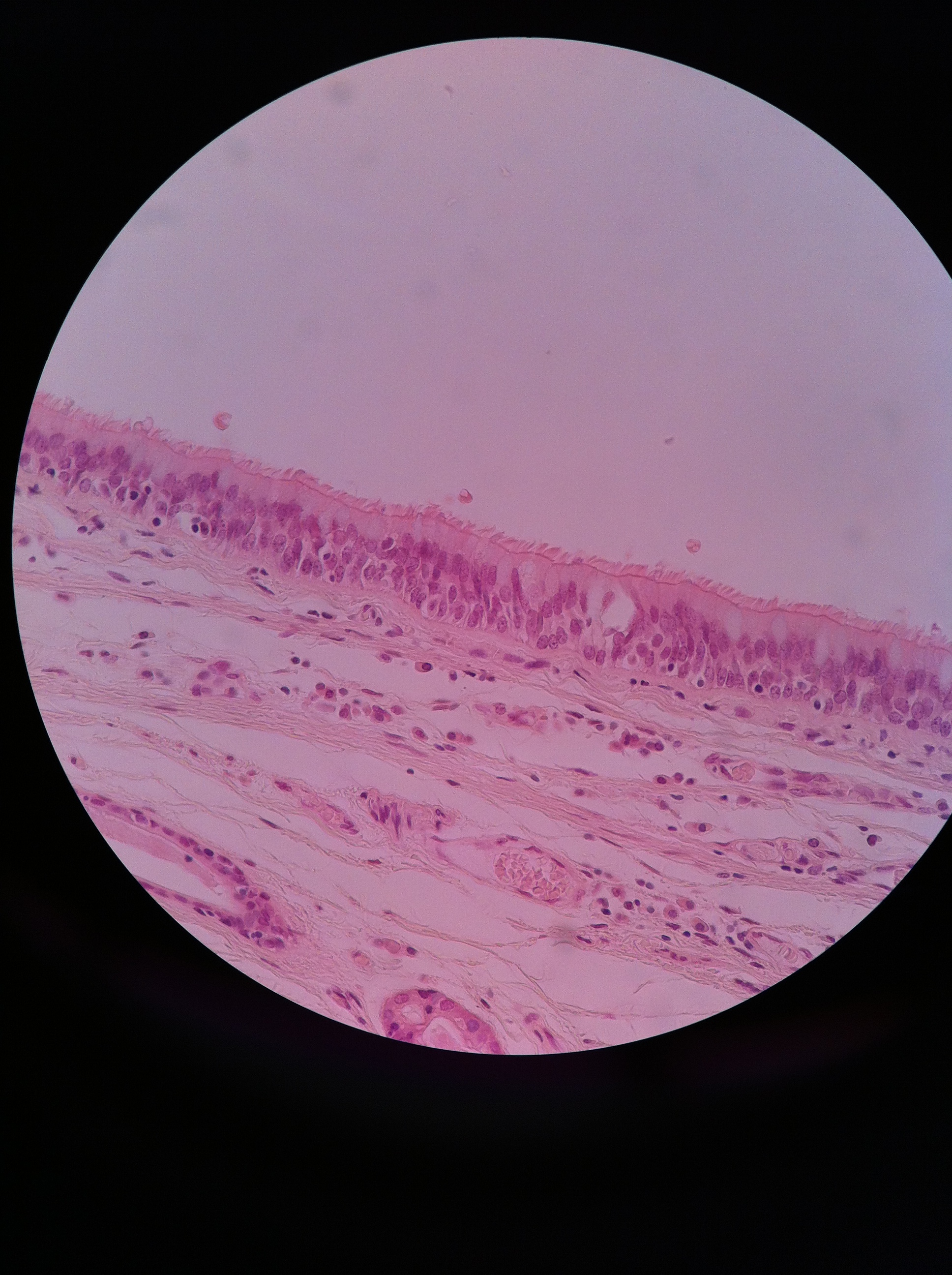 Pseudostratified ciliated columnar (trachea) 400X