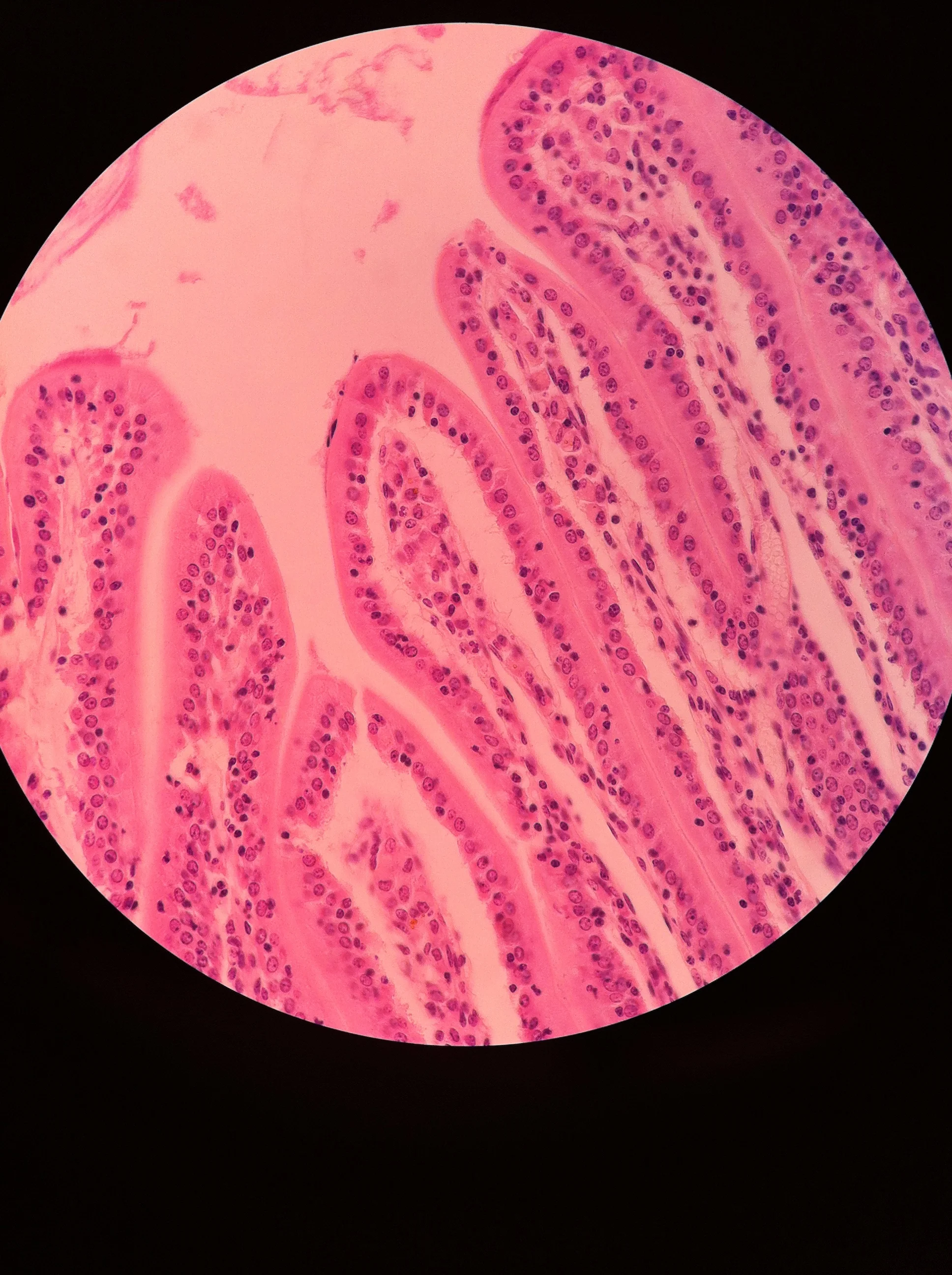 Epithelial Tissues — See Why Anatomy