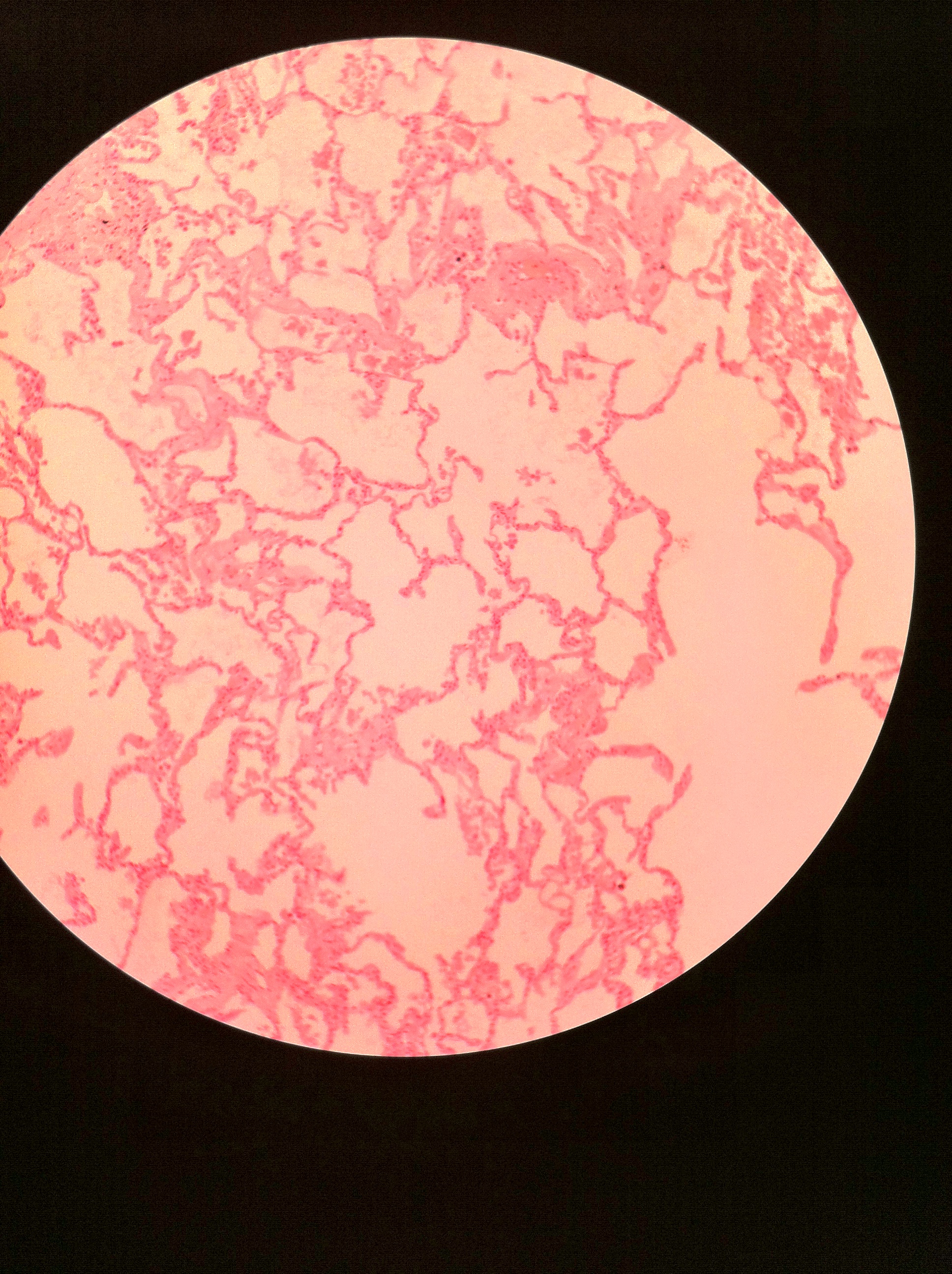 simple squamous (lung) total mag:100X