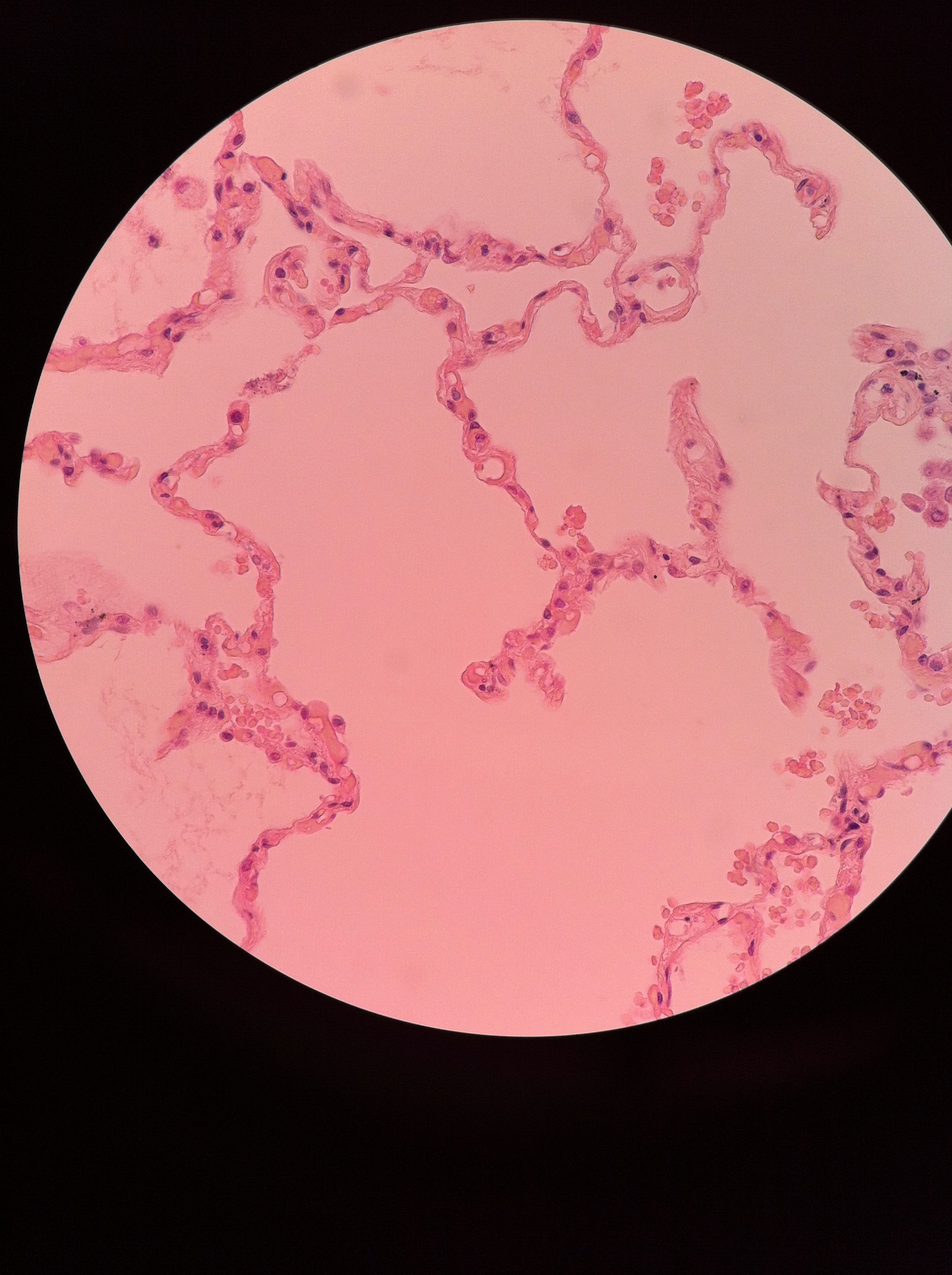 simple squamous (lung) 400X