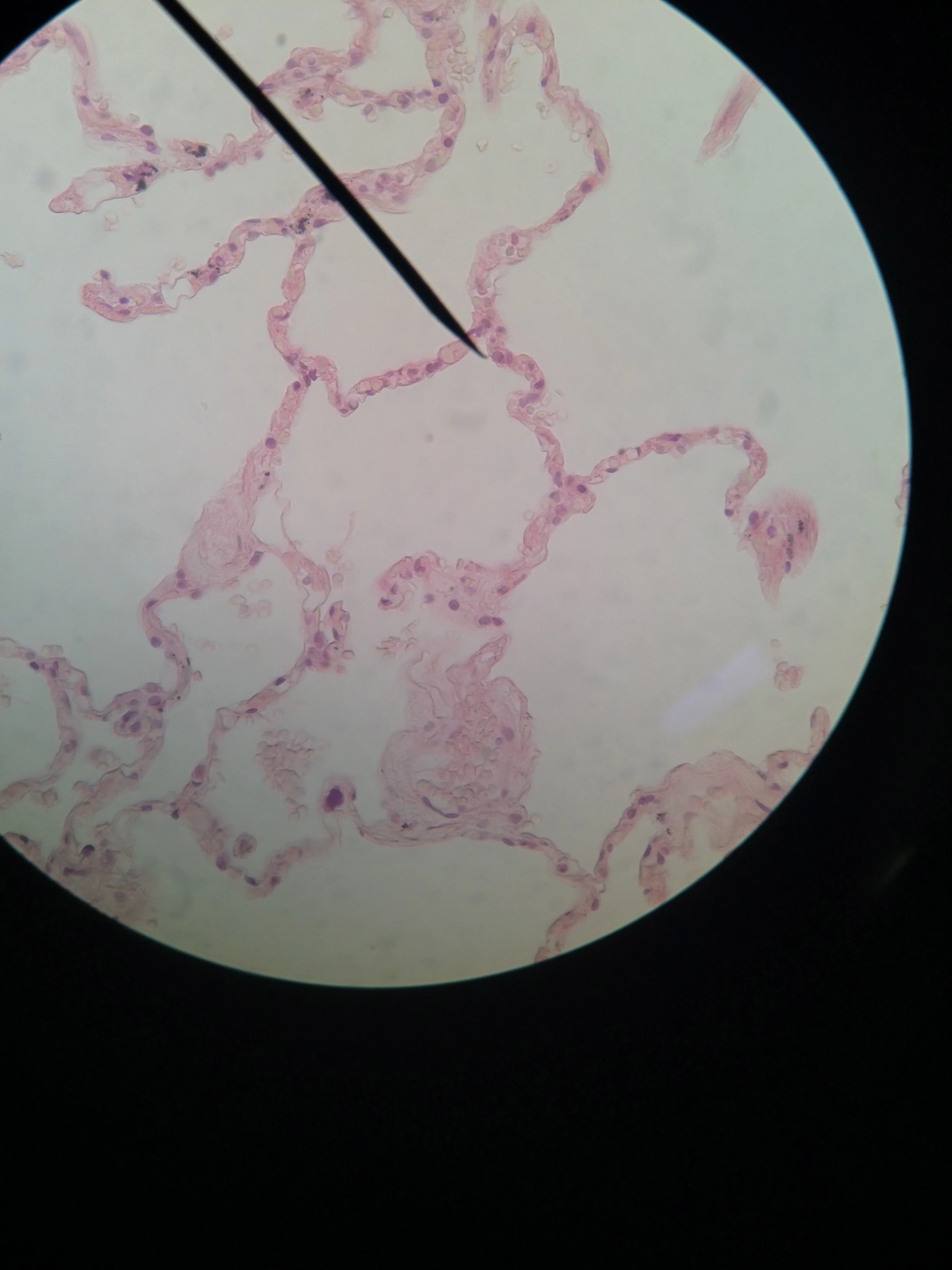 simple squamous (lung) 400X