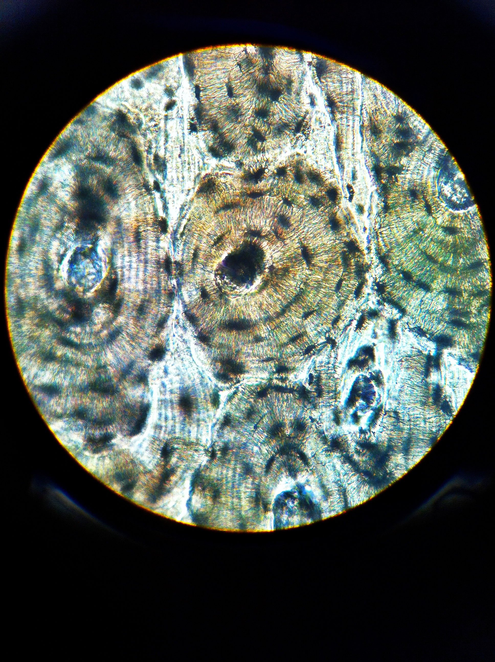 Compact Bone, calcified (xs), Total Mag: 400X