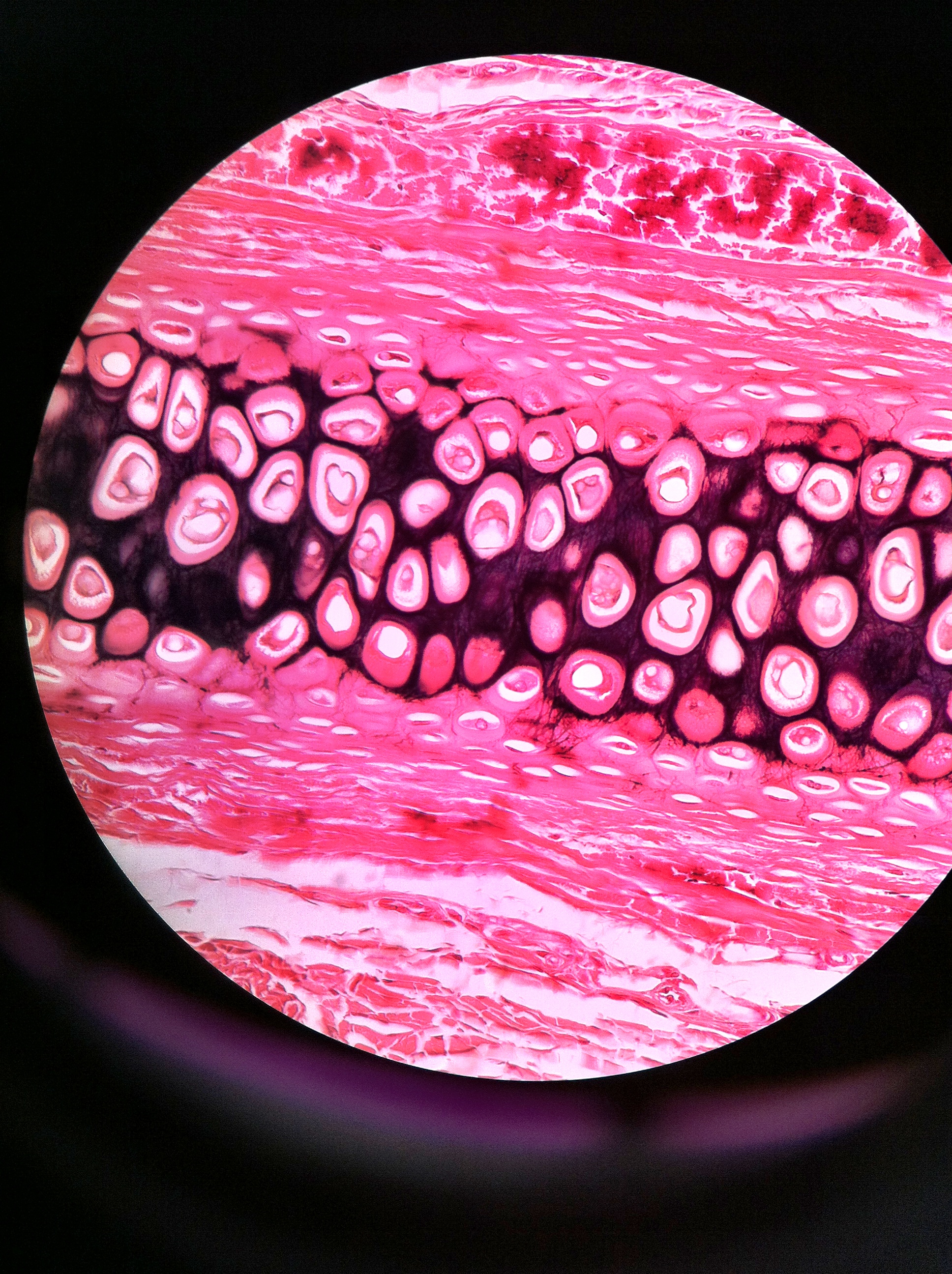 elastic cartilage, (Verhoeff stain) Total Mag: 400X