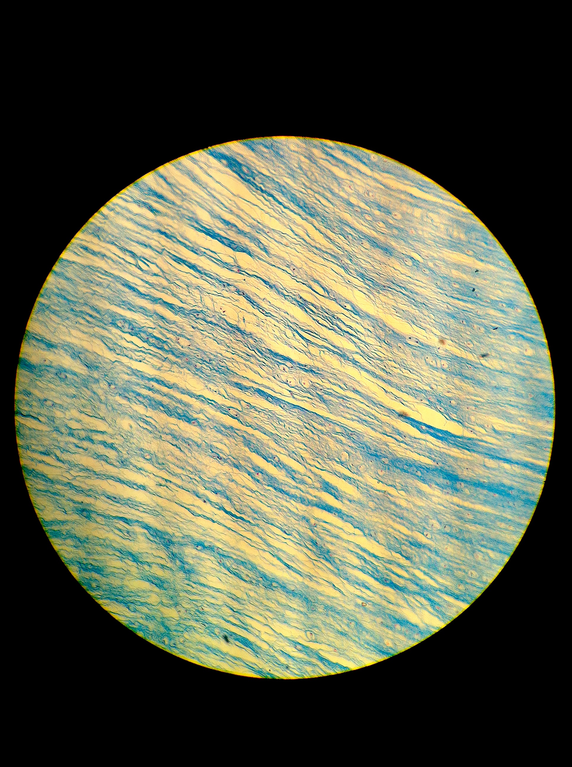 Fibrocartilage, Total Mag: 100X