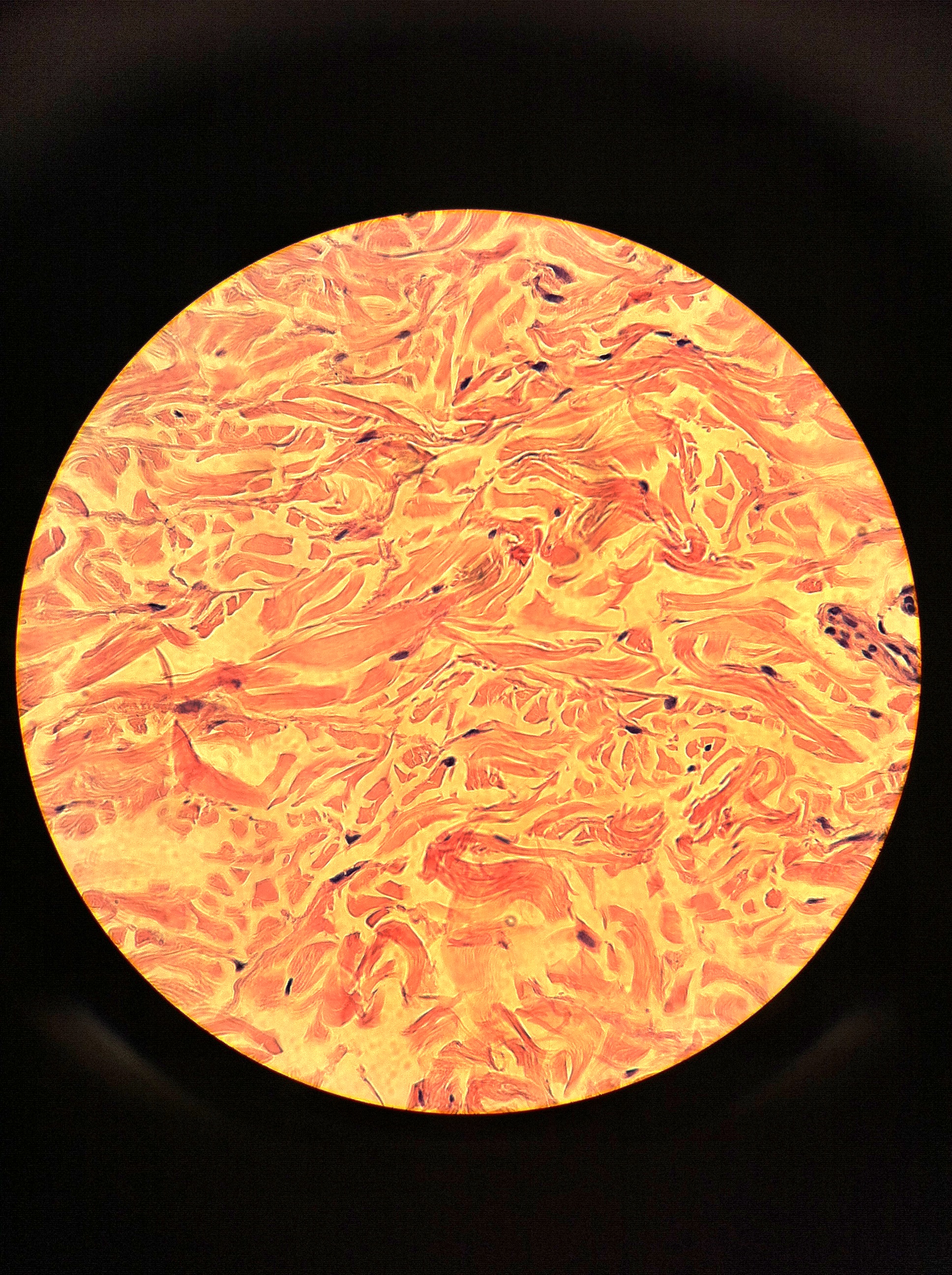 dense irregular (dermis of skin), Total Mag: 400X