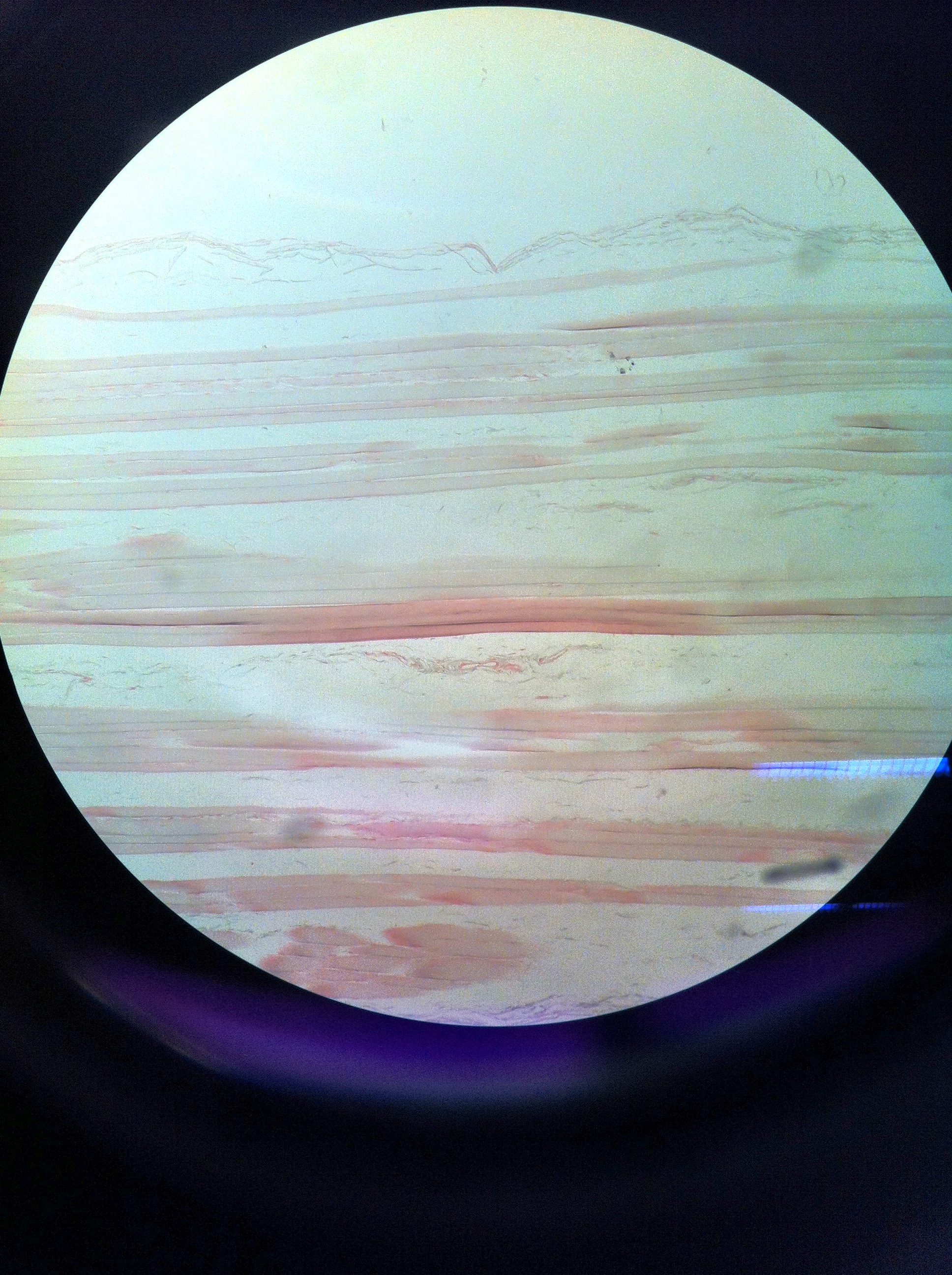 skeletal muscle (ls) Total Mag: 100X