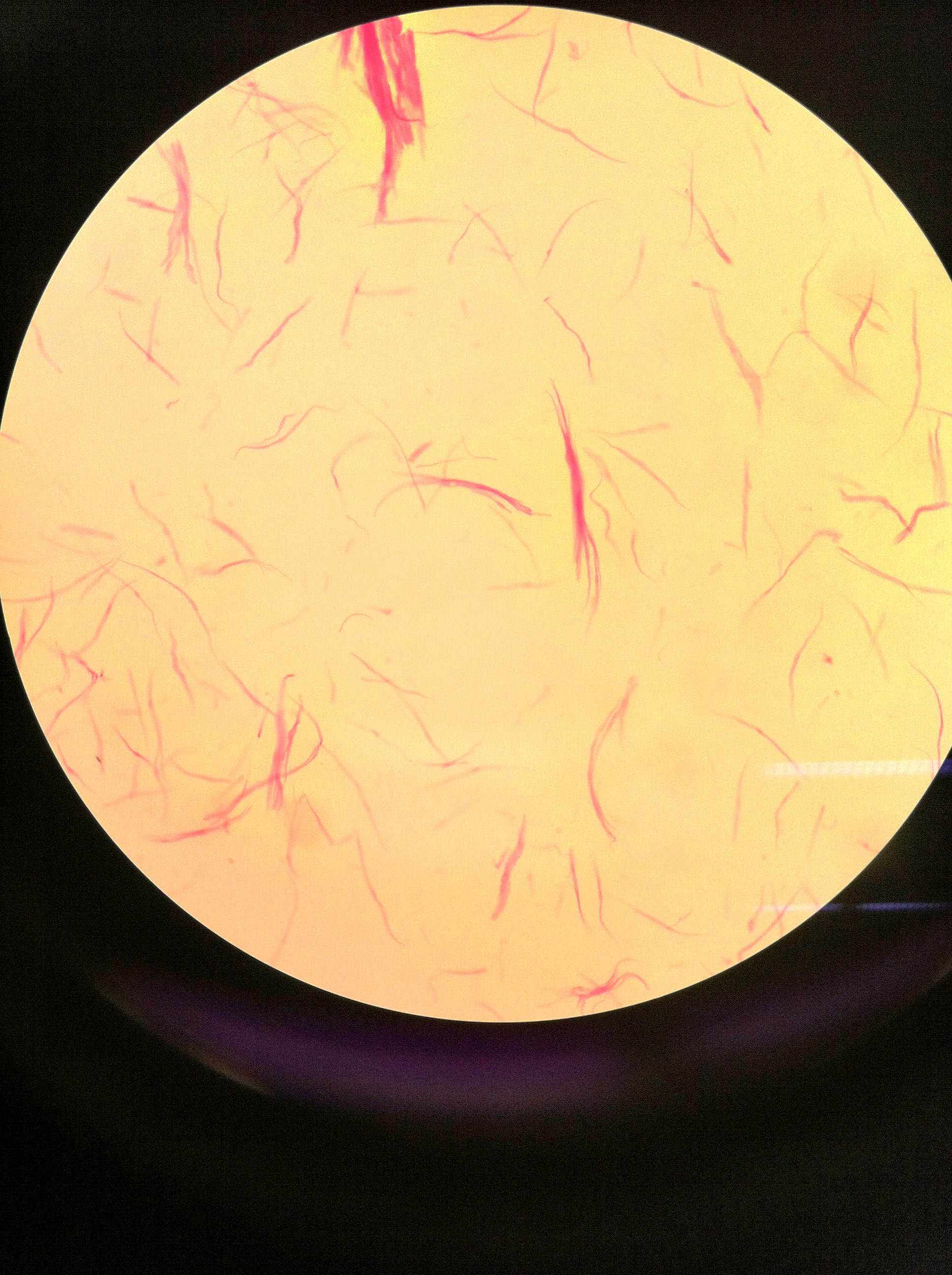 smooth muscle (teased), 100X