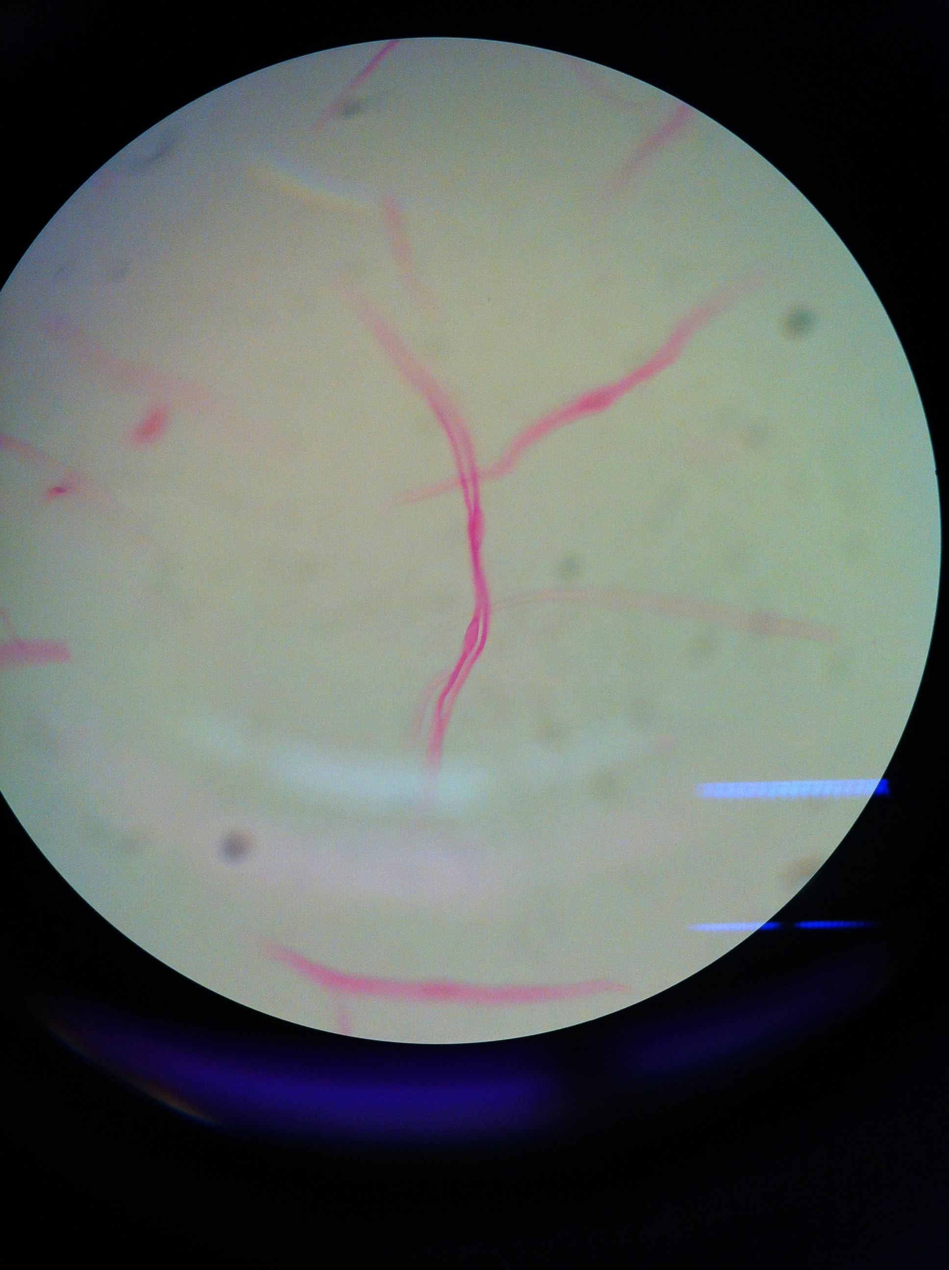 smooth muscle (teased), 400X