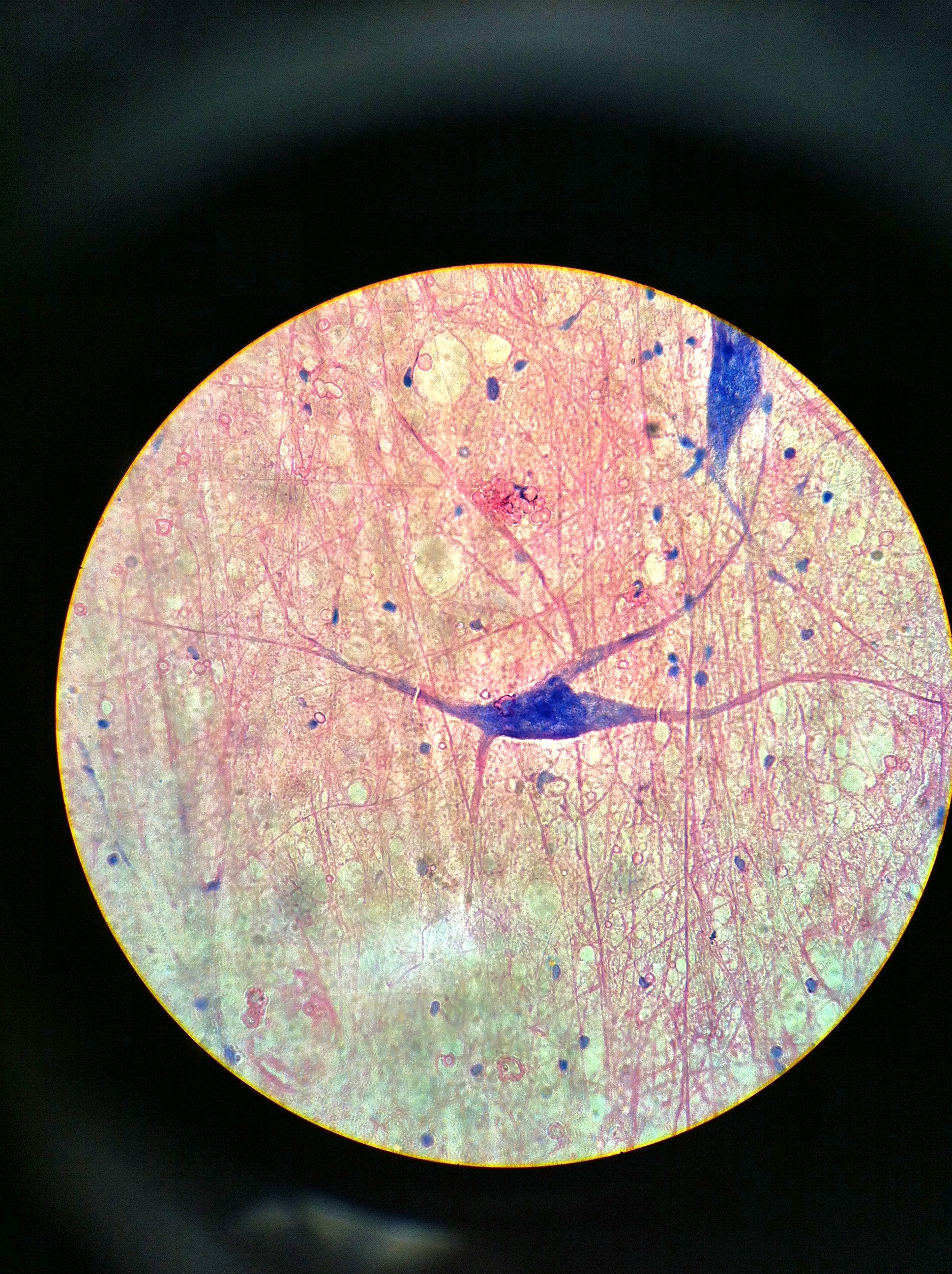 Neuron (giant multipolar, spinal smear), Total Mag: 400X