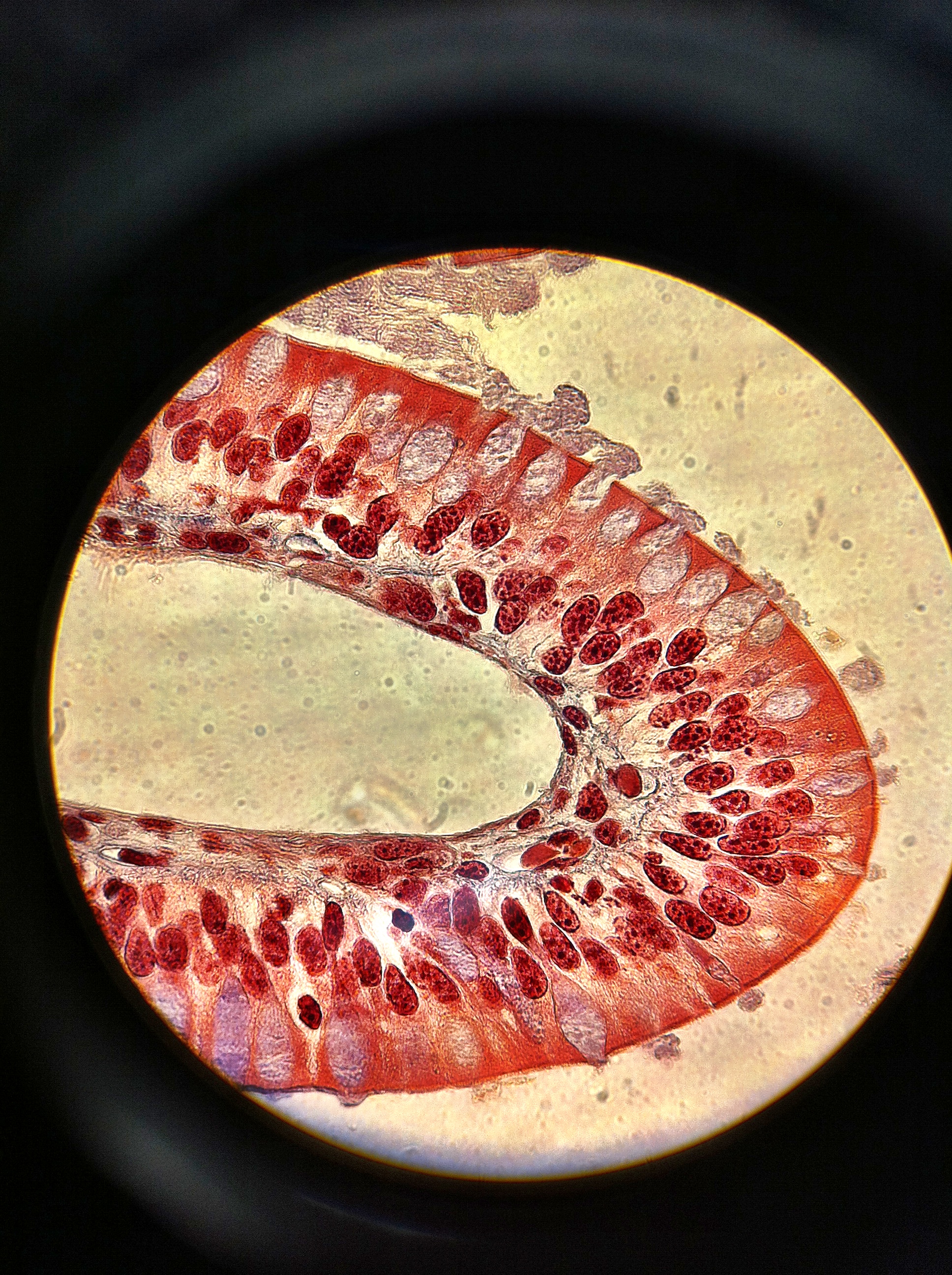 Goblet Cells, Total Mag: 400X