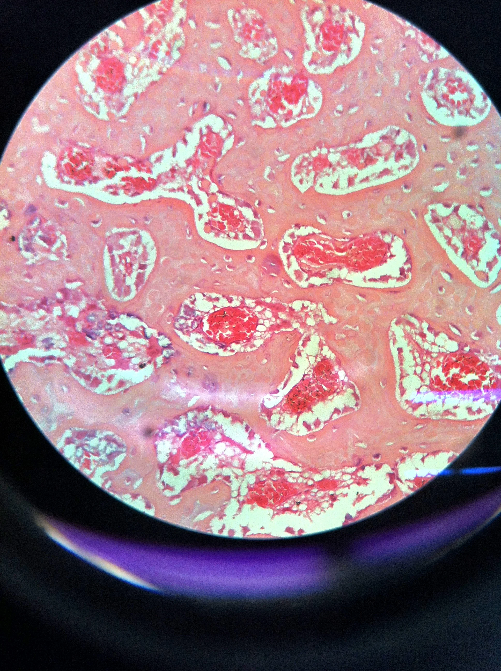 Bone Anatomy — See Why Anatomy