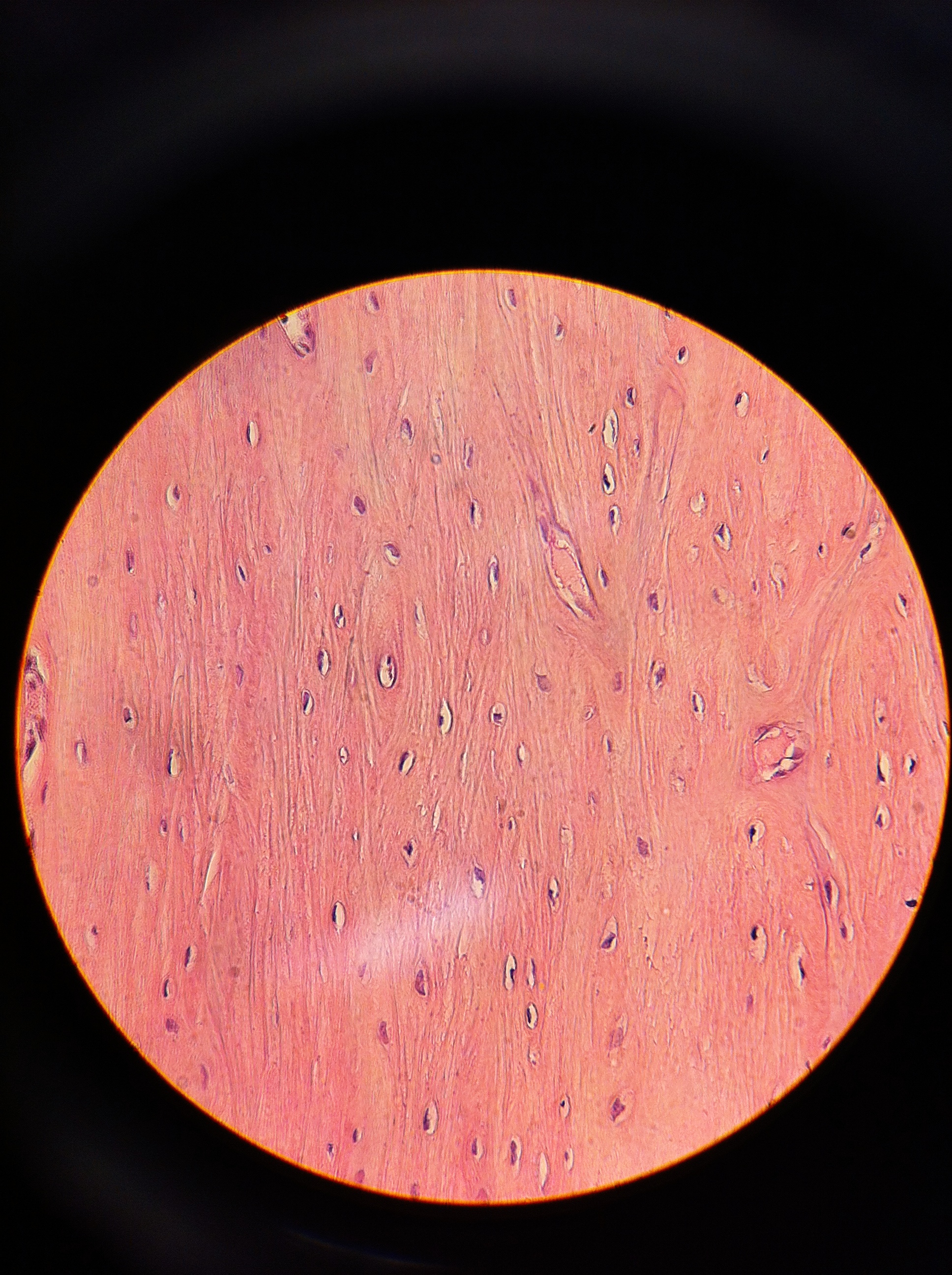 Decalcified Bone (ls), Total Mag 400X
