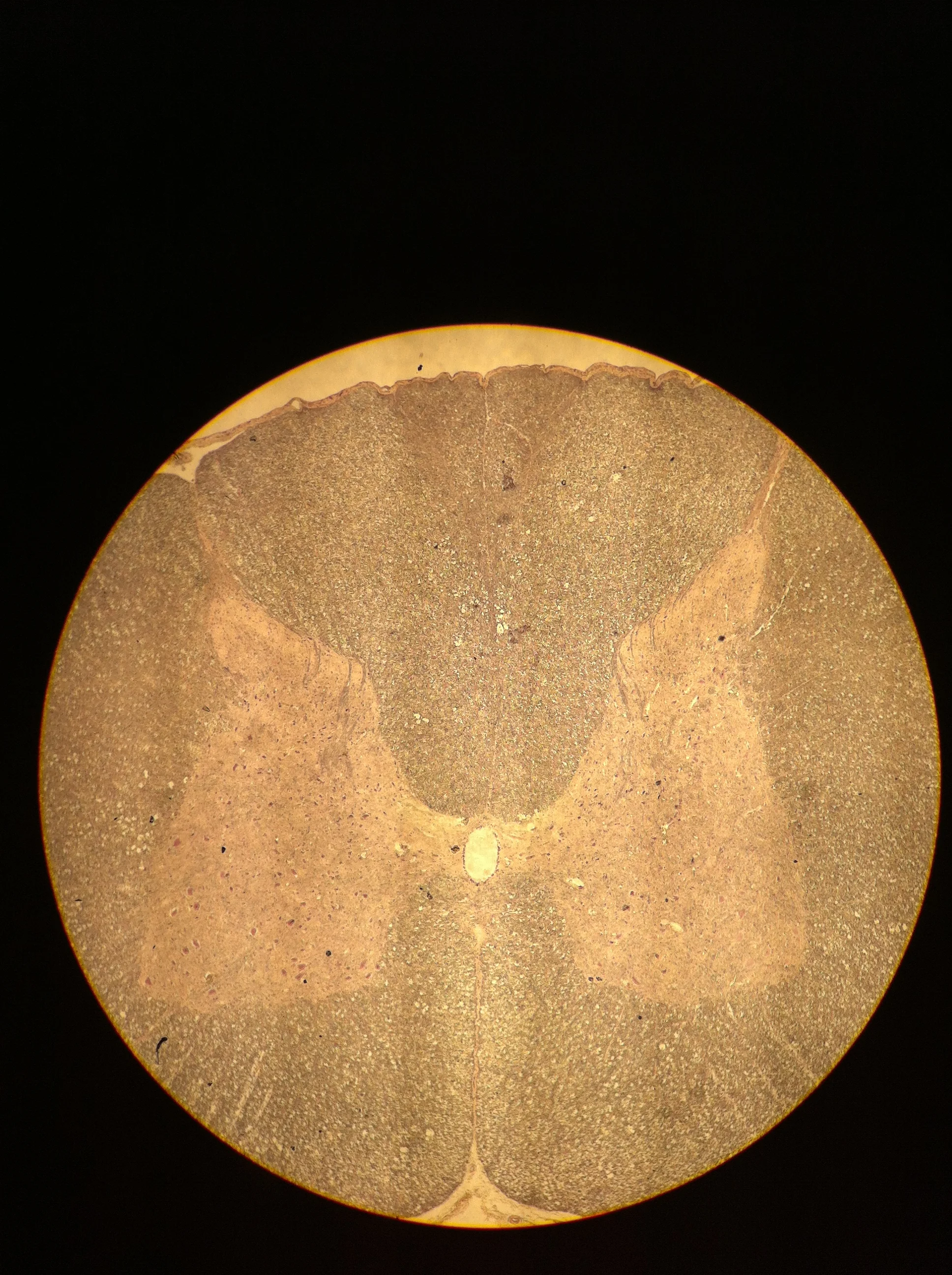 Cervical Spine 40X